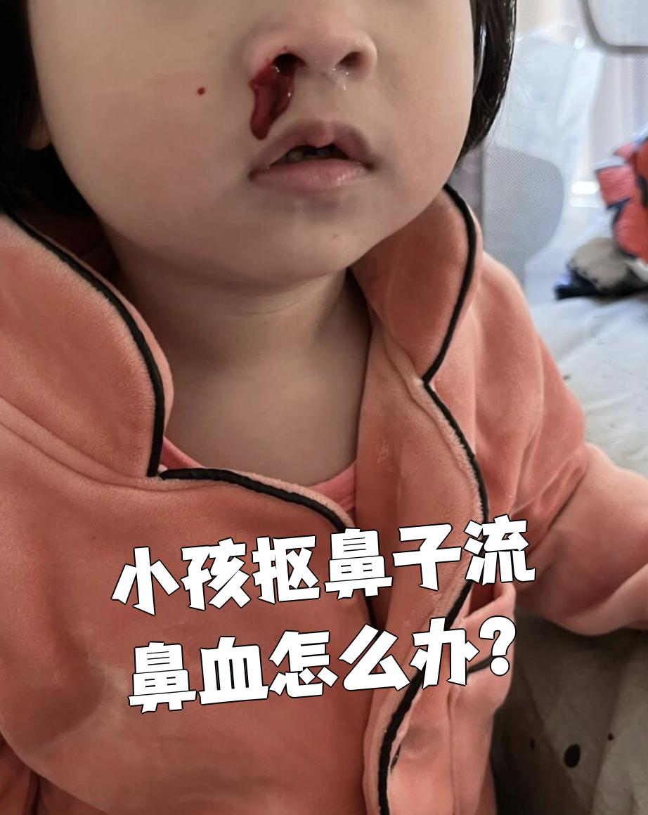 小孩子为什么老是流鼻血