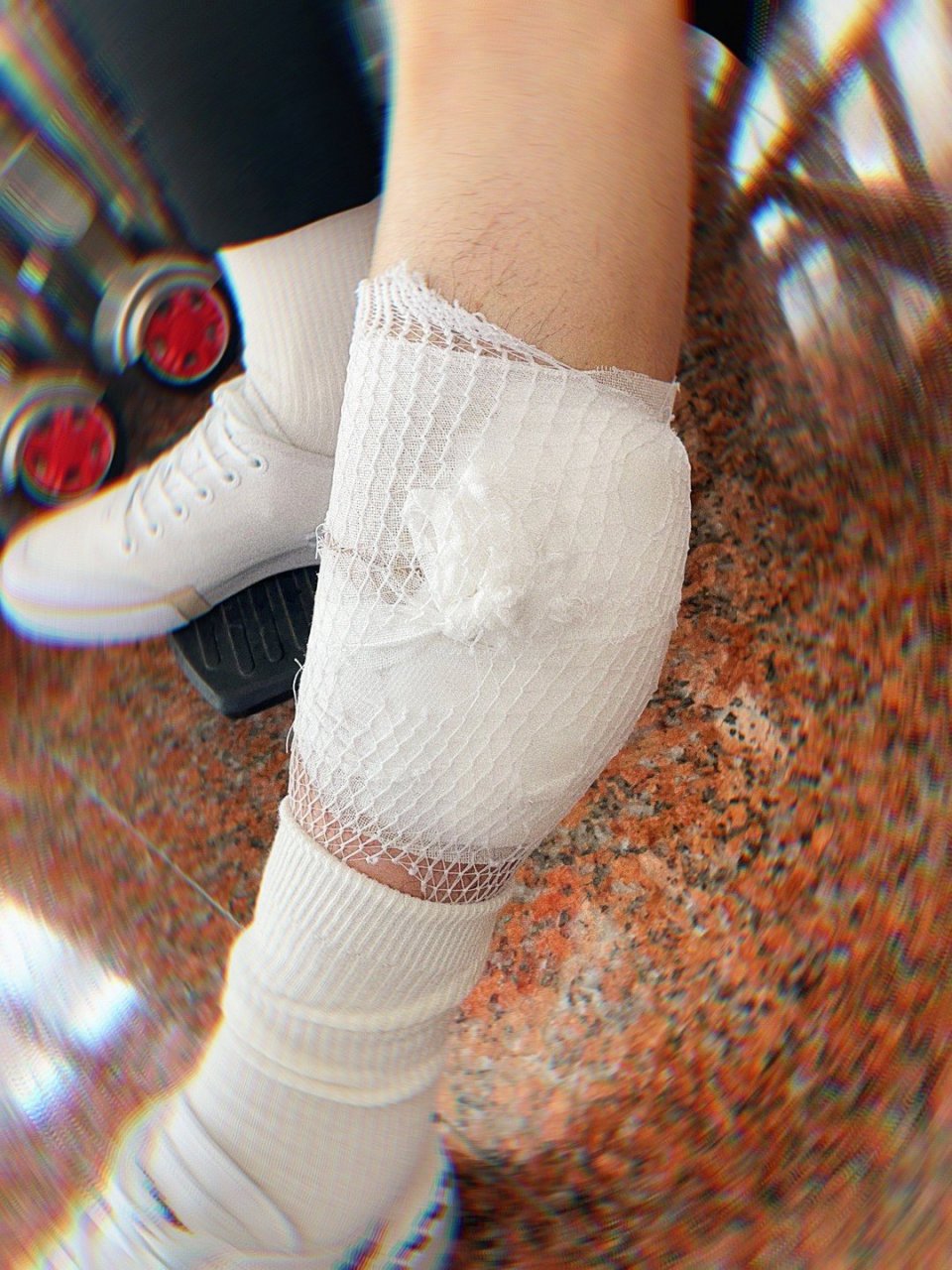 陈立农微博晒出自己受伤的腿缠满纱布的照片,还说"大家也别担心 医生