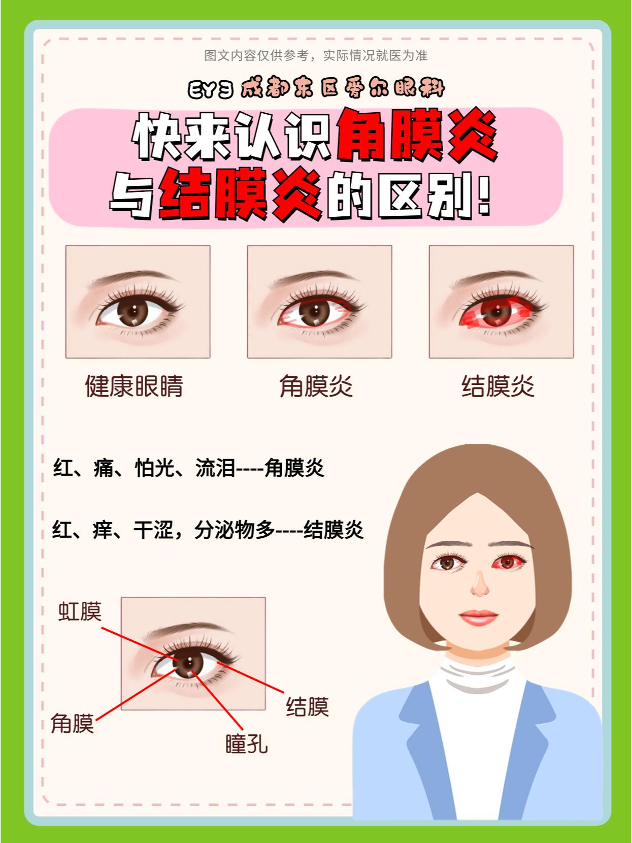 快来认识角膜炎与结膜炎的区别!