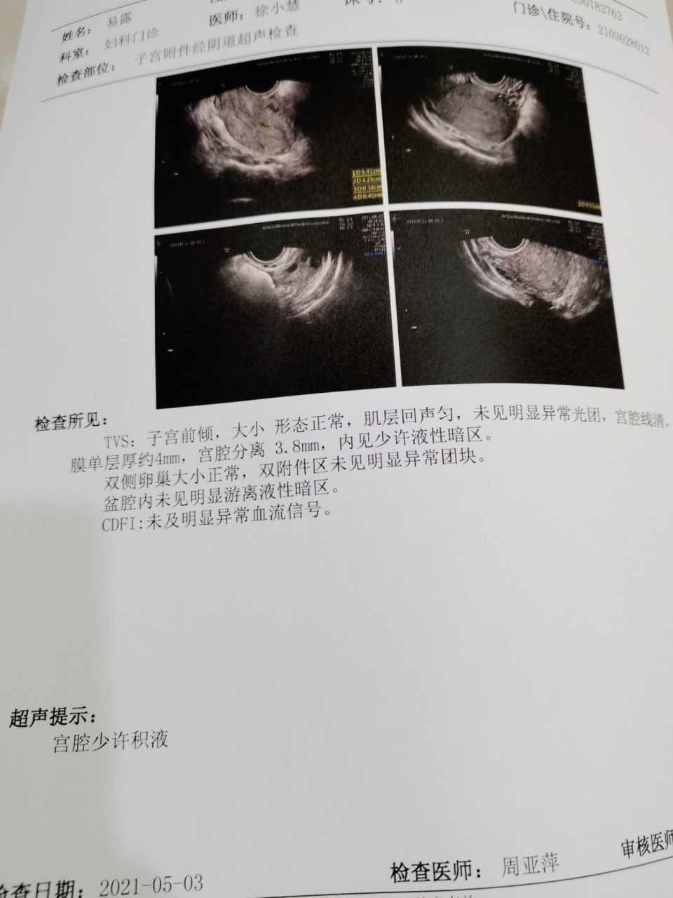 接着打了三天缩宫针,这个药水是真的疼,期间陆续