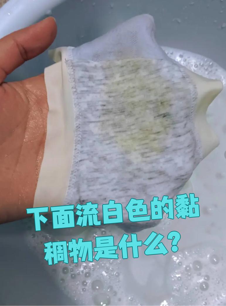 如果是正常的白带,很多育龄期女性都会有这种情况