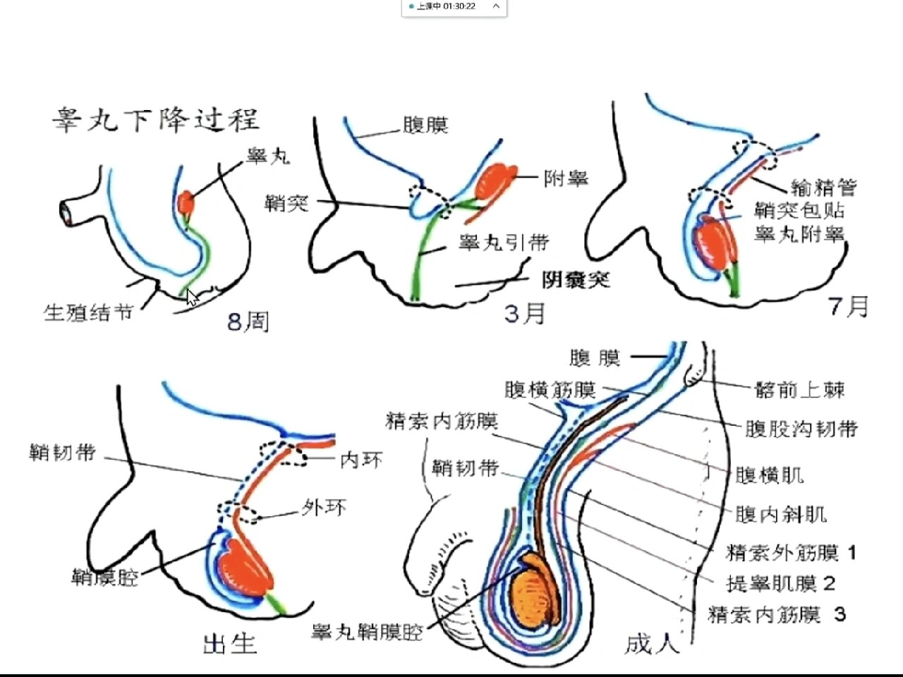 睾丸发育 下降 斜疝