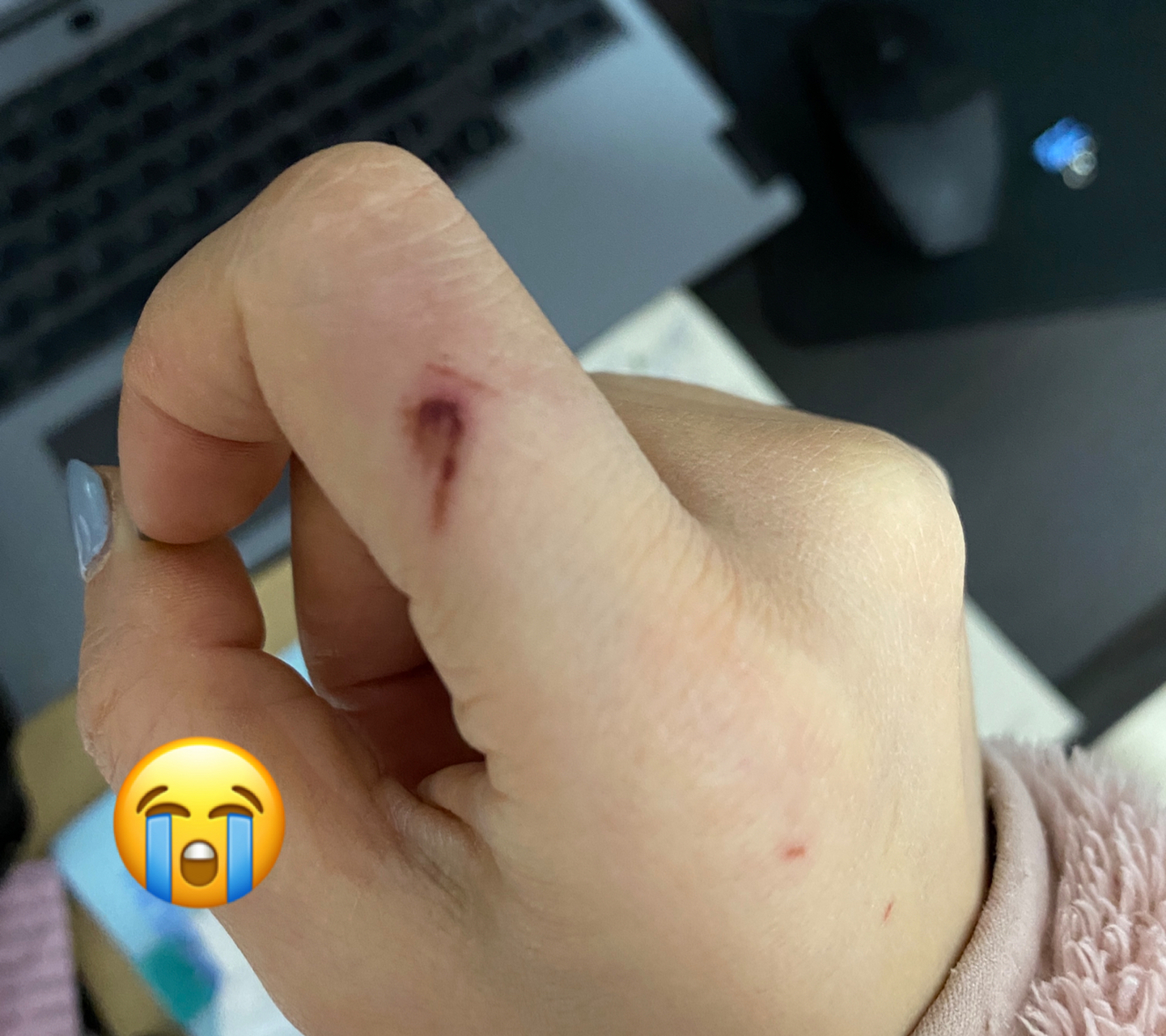 昨天晚上6点多7点的样子,因为小兔子猴急咬大兔子,我去护大兔子,然后