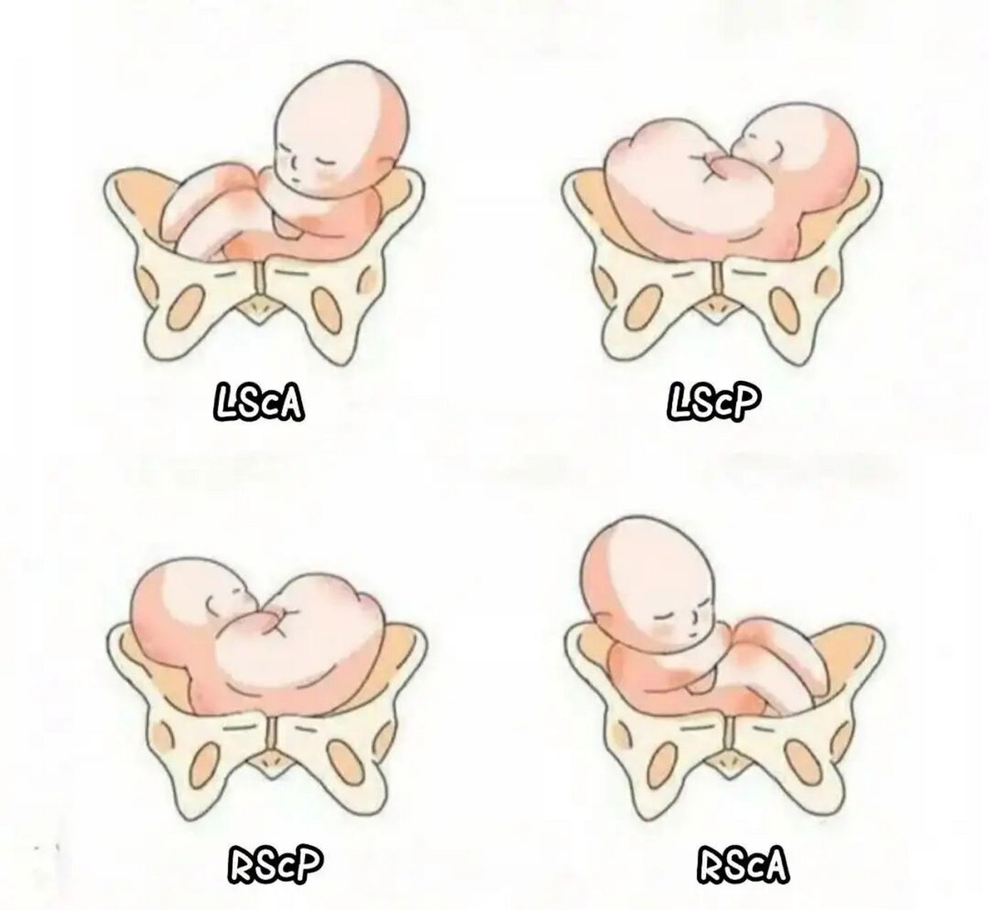 一图看懂胎方位 胎方位是指先露部的指示点与产妇骨盆的关系.