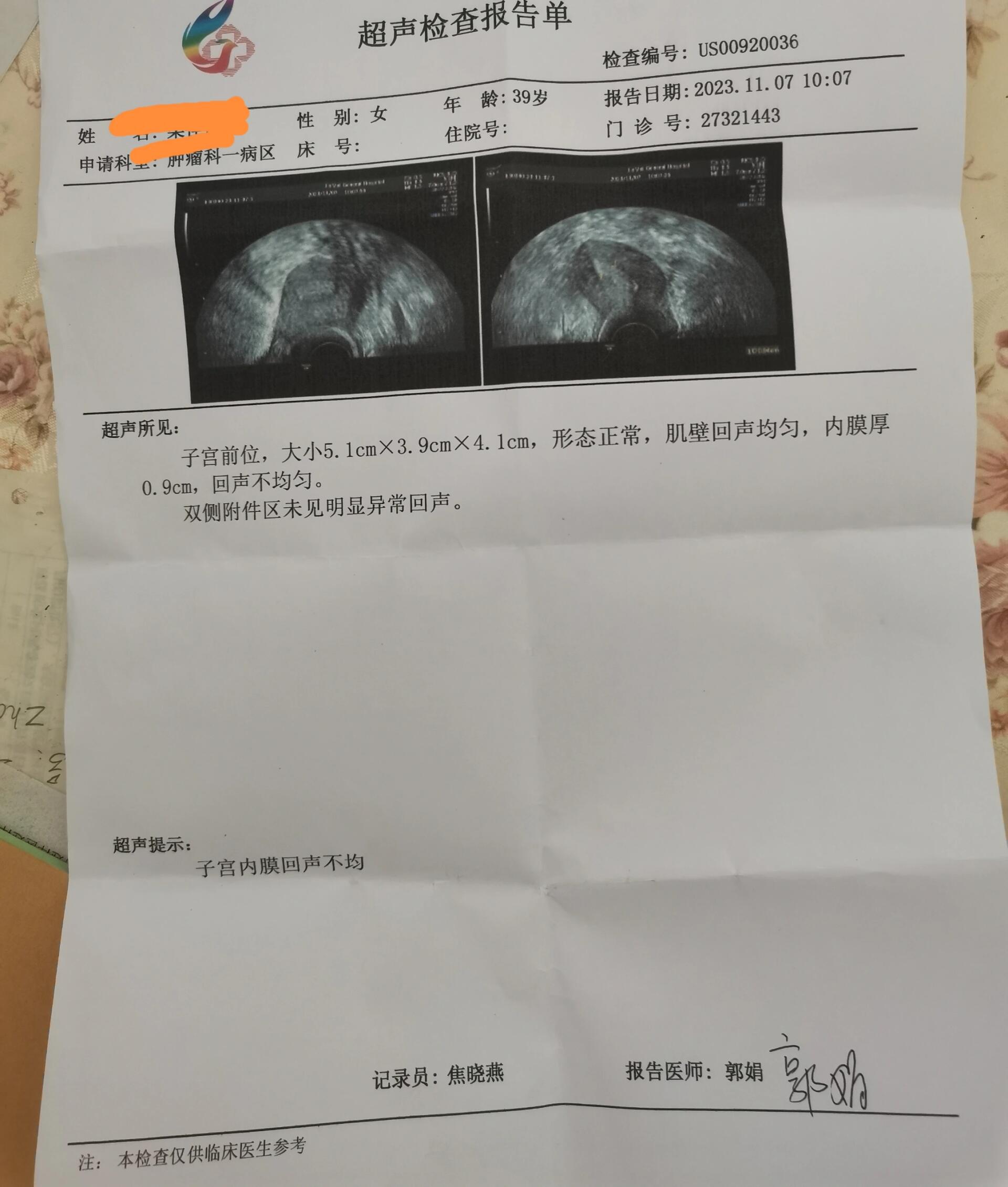 他莫昔芬服用一个半月,因为从化疗后就没有了例假,所以进行了阴超检查