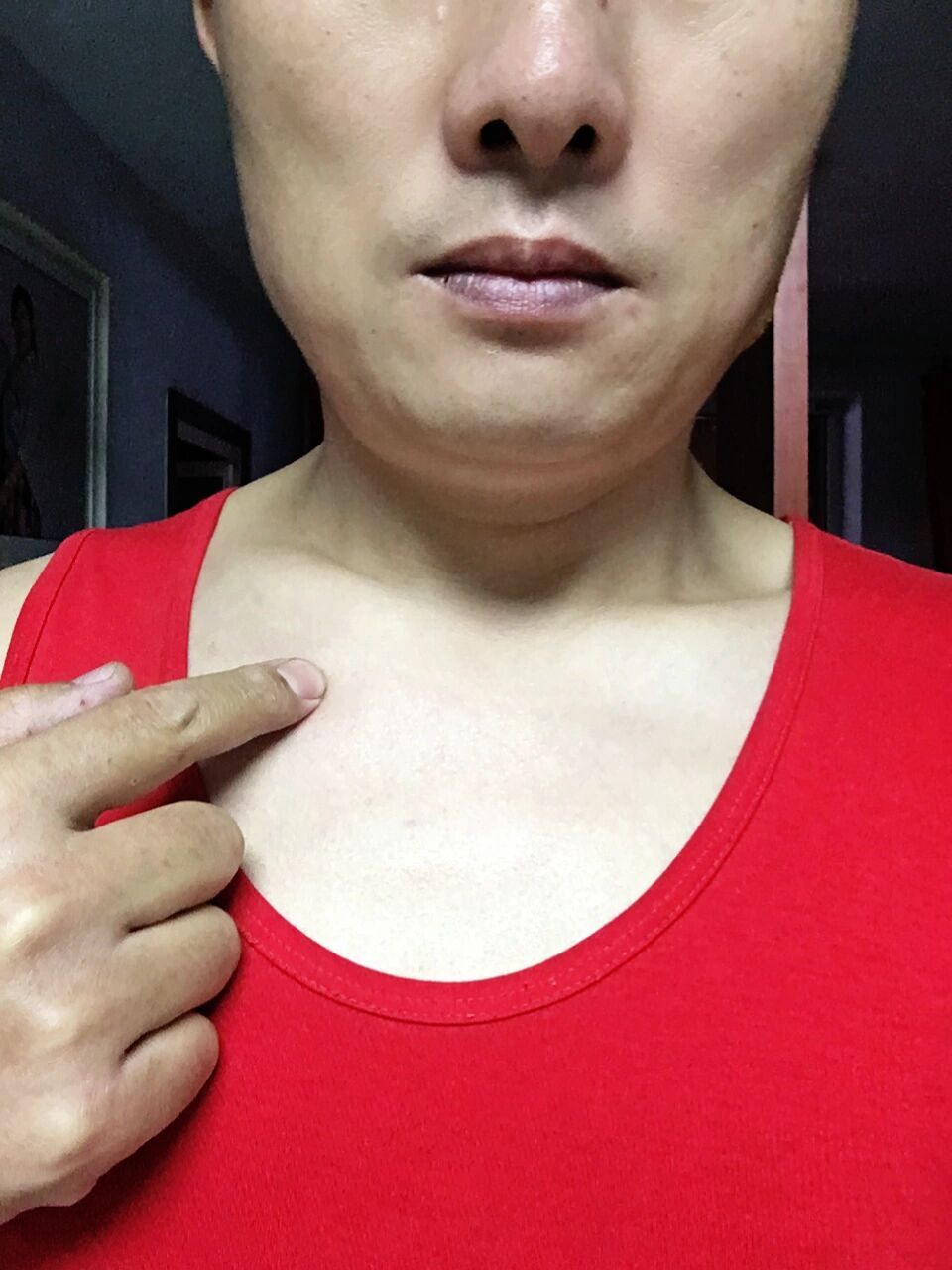 左胸锁骨下有个包,一按很痛,胸口好像有点憋气,有谁知道告诉下