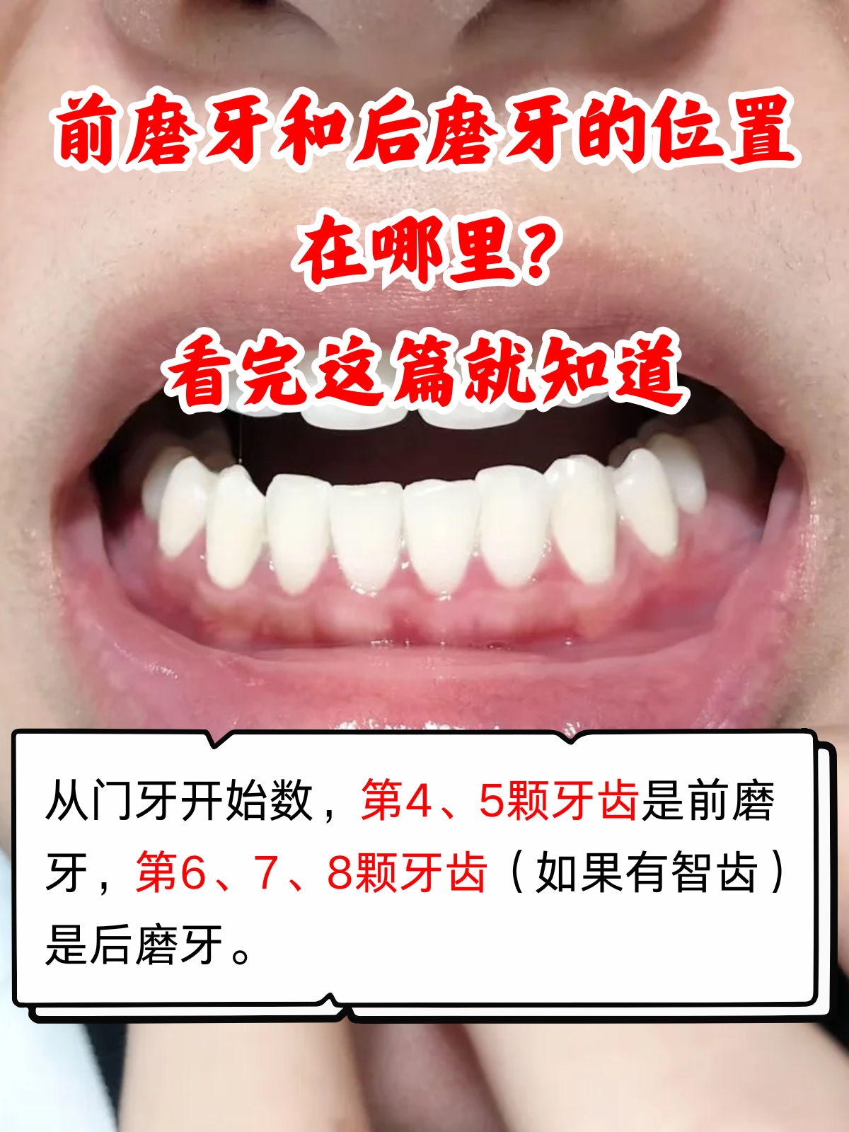 前磨牙和后磨牙的位置在哪里?
