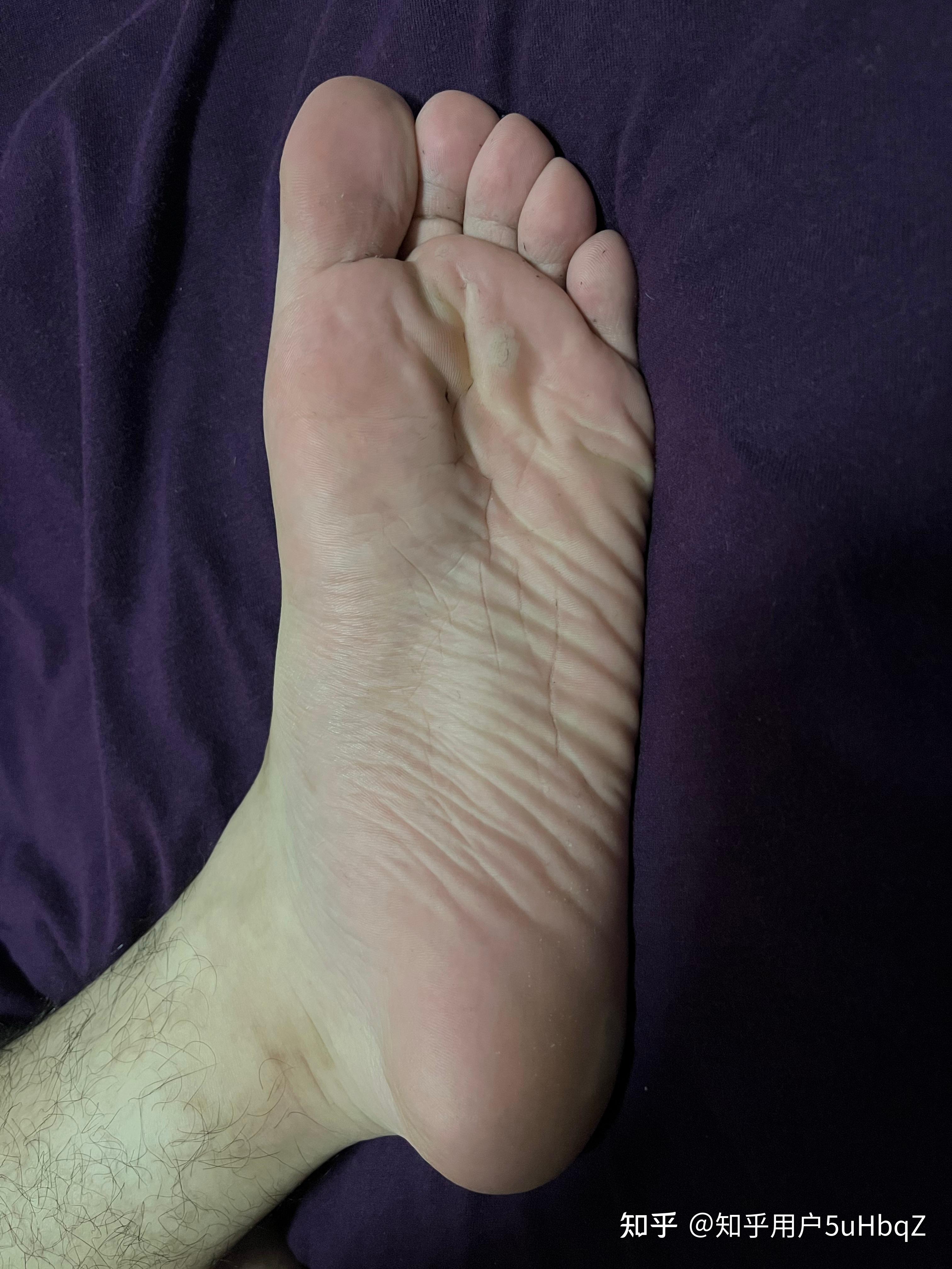 有没有18岁男孩子的脚底图片