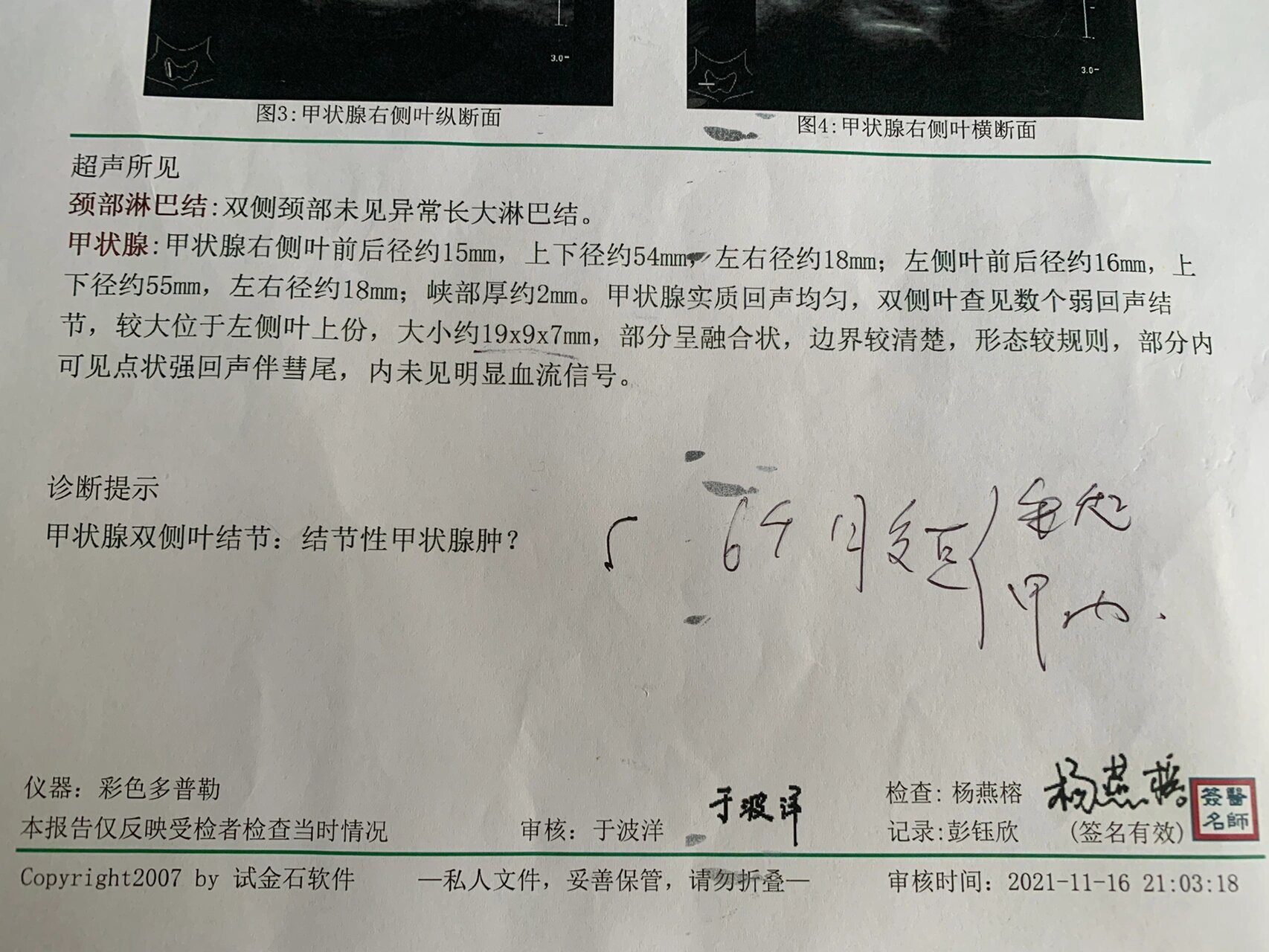 甲状腺结节 点状强回声伴彗尾 第一张图是去年的检查,第二张是17年的