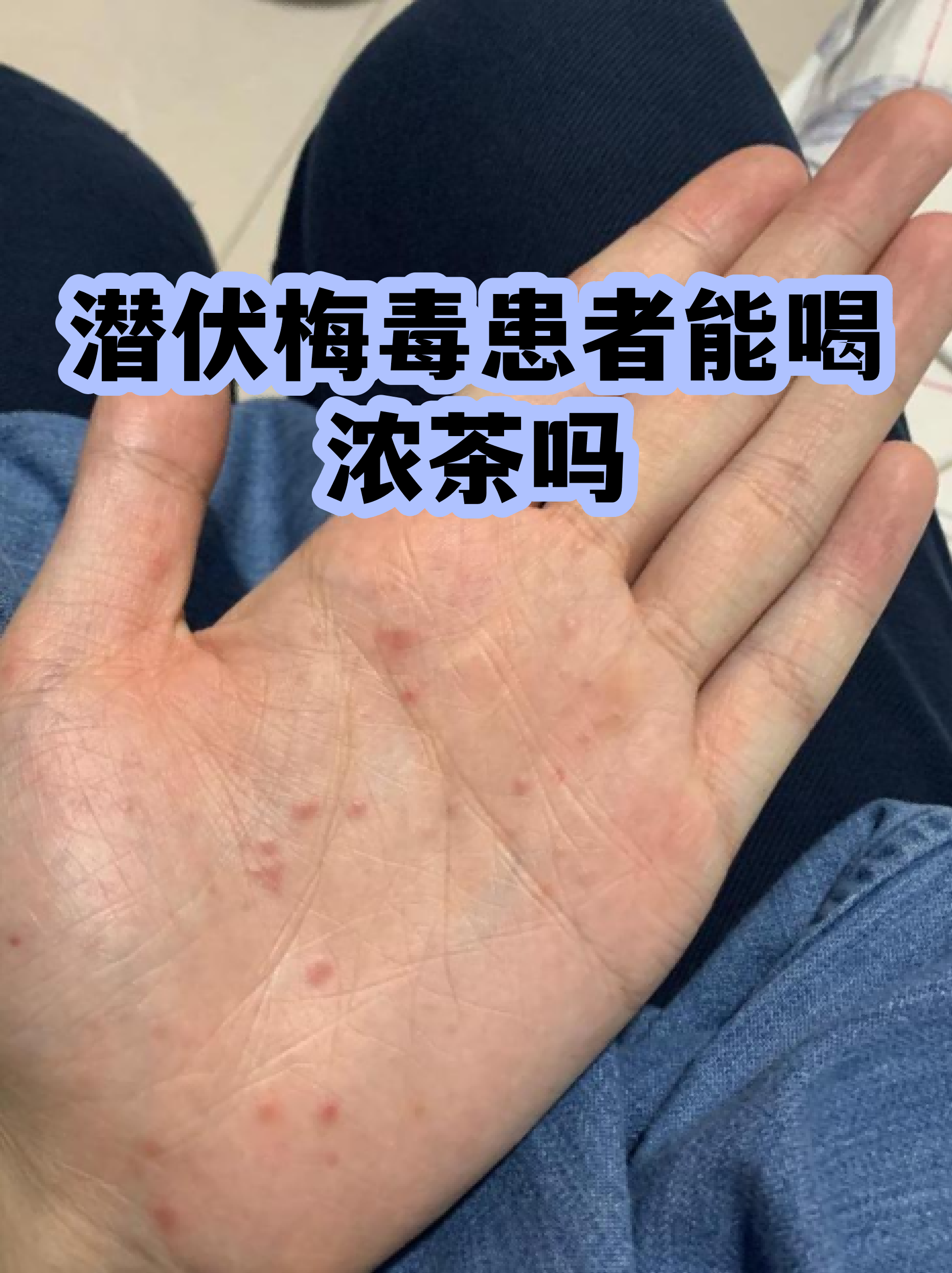  疫情过后一般会出现哪些问题发生呢英文(疫情过后可能出现的问题)