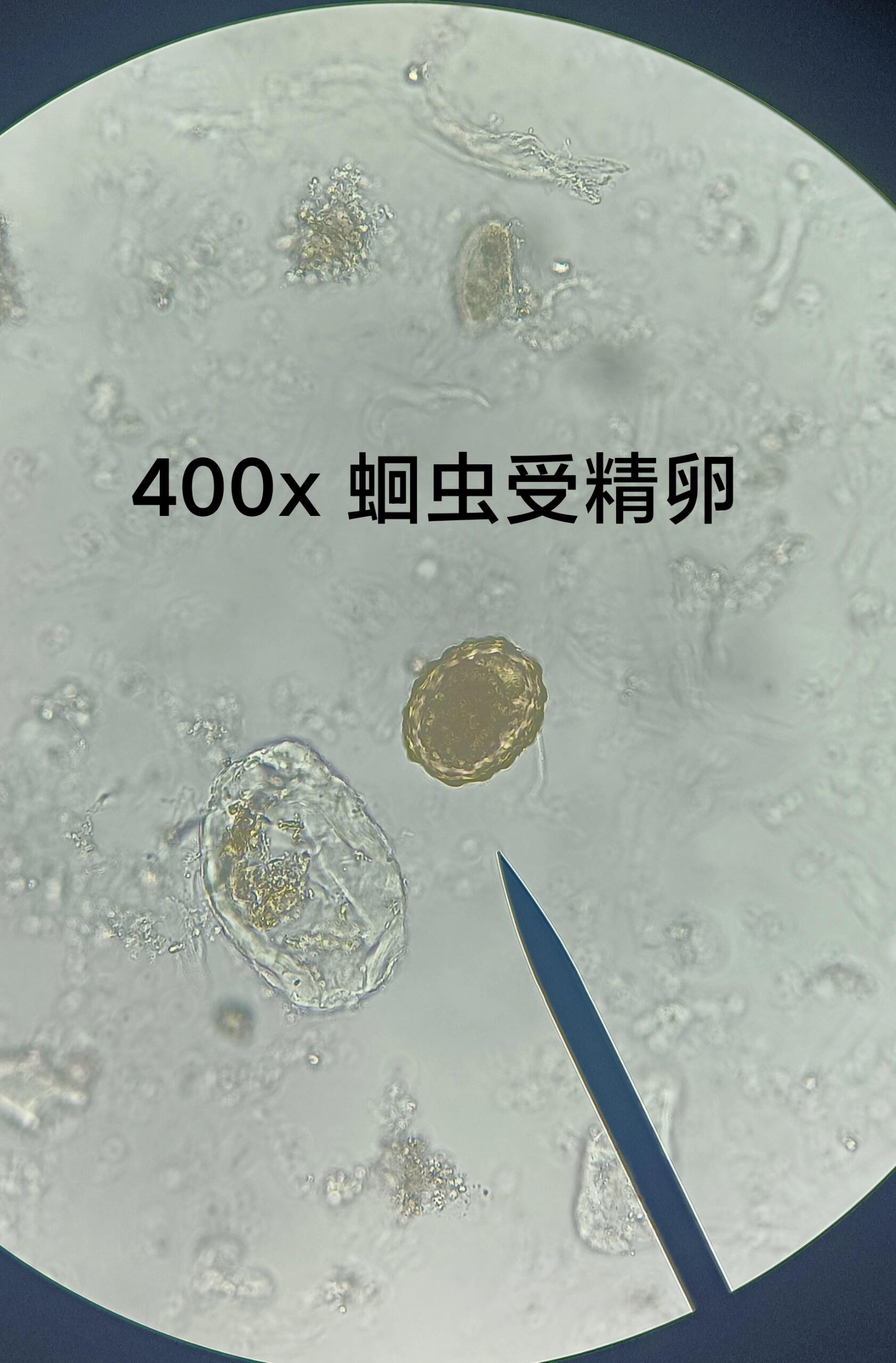 绕虫卵镜下图片