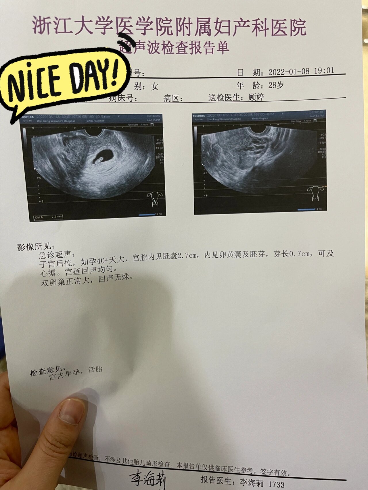 来报喜了,接了一个星期的好孕,终于昨天晚上去检查