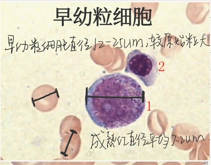 x小体的细胞图图片