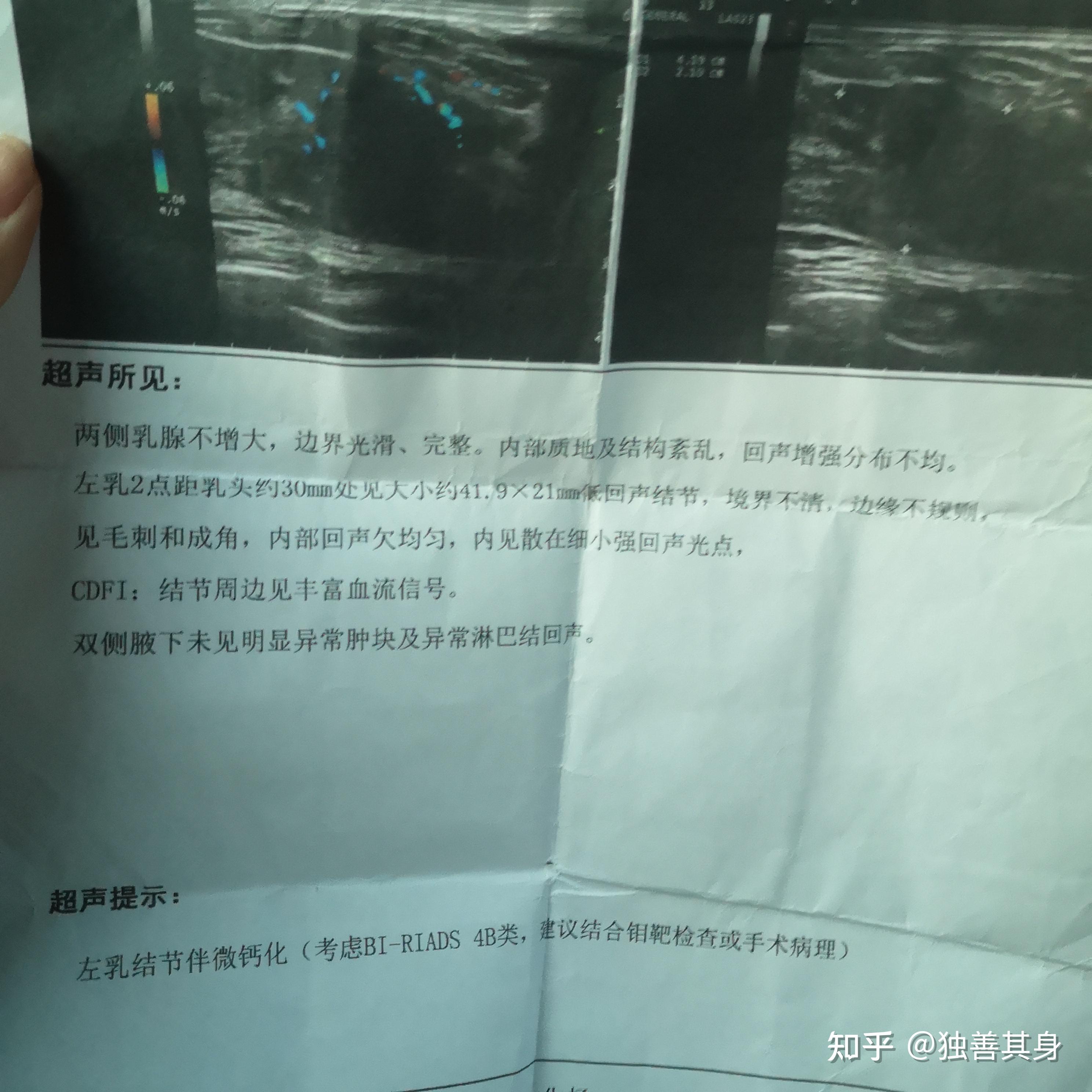 乳腺活检报告图片