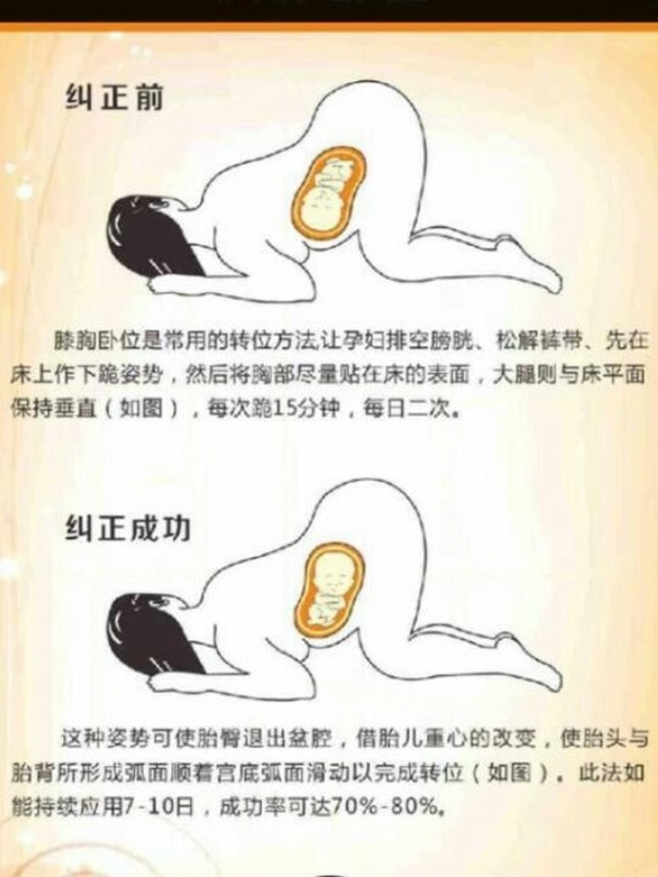 调整臀位正确姿势图图片