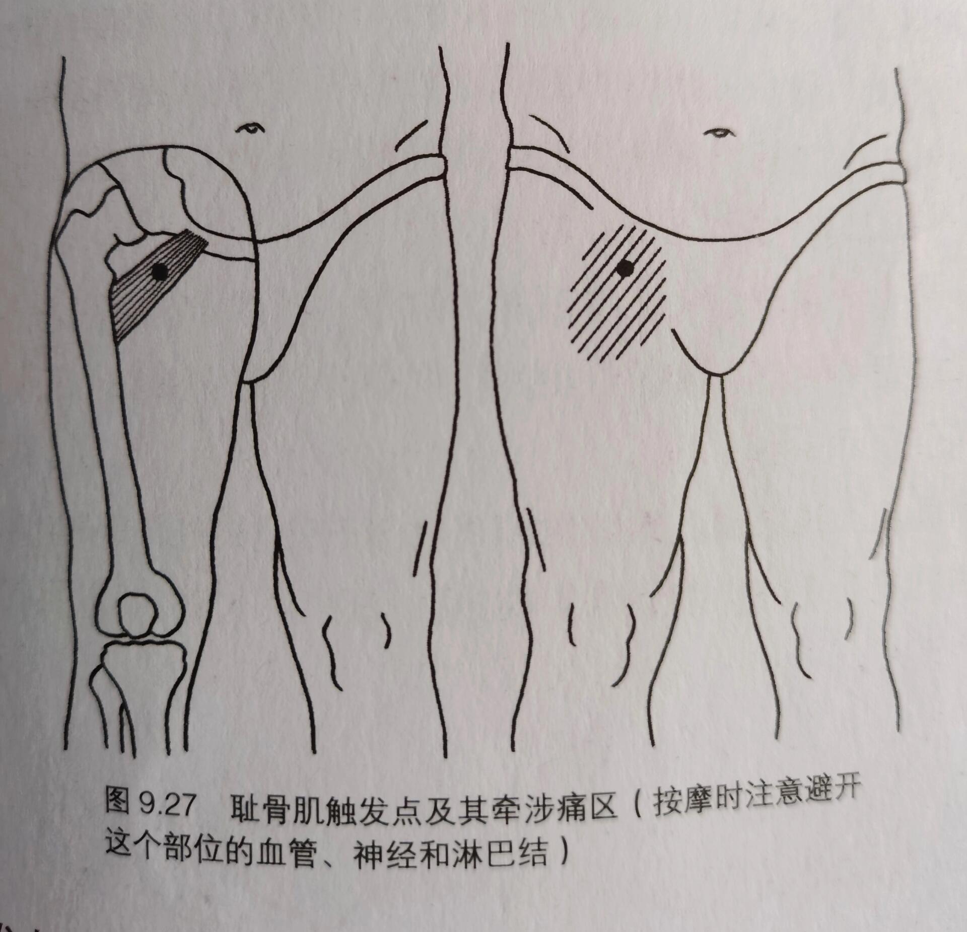 大腿内侧肌肉