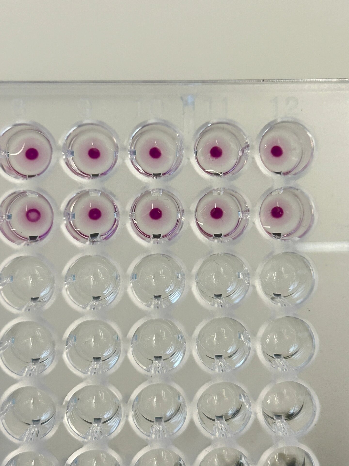 检验人 | tppa判定和假阳性 隐性梅毒诊断依据为: (1)符合临床流行病