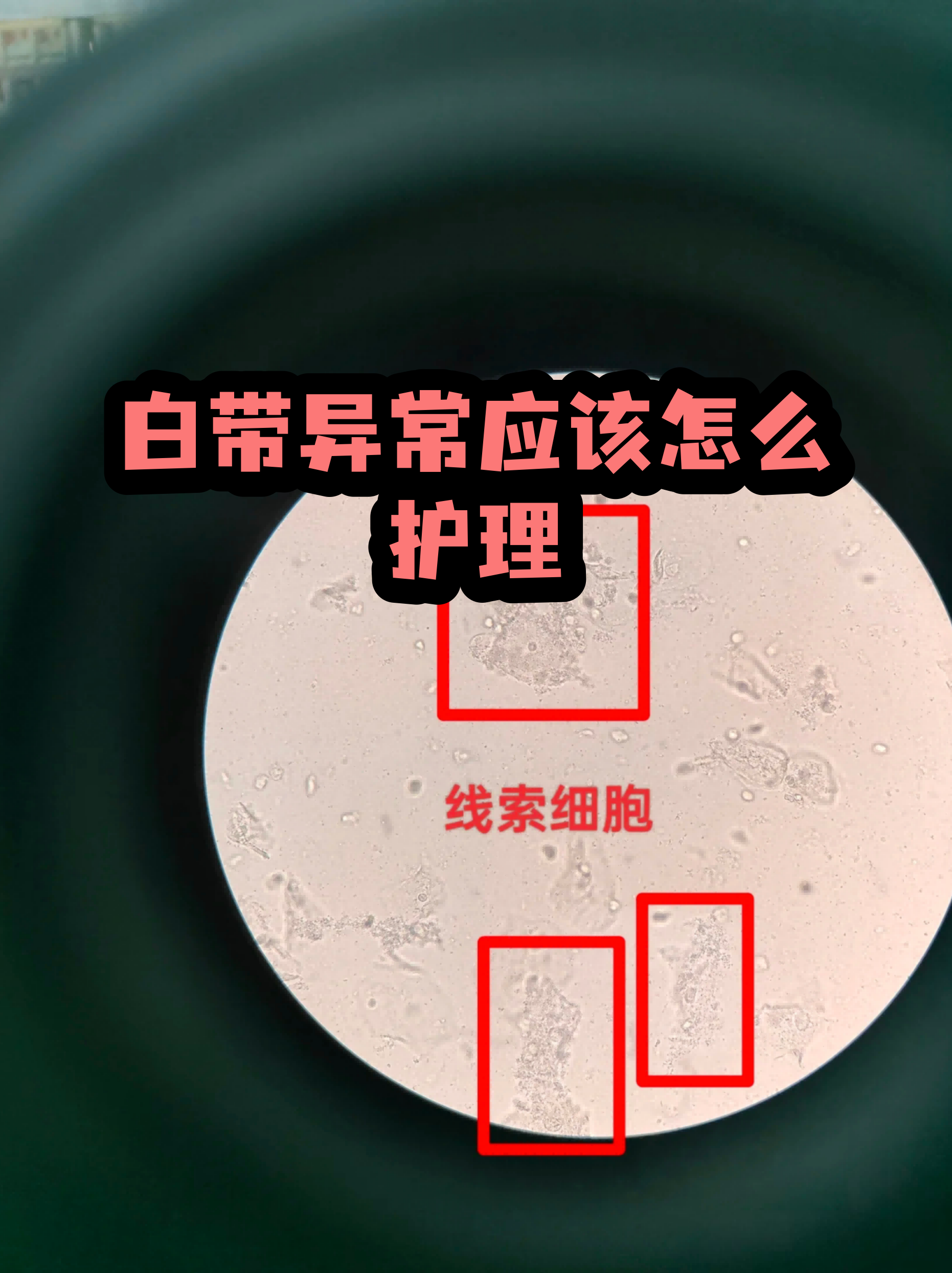 关于阜外医院帮忙挂号陪同看病出院居家护理提醒，科学恢复身体的信息