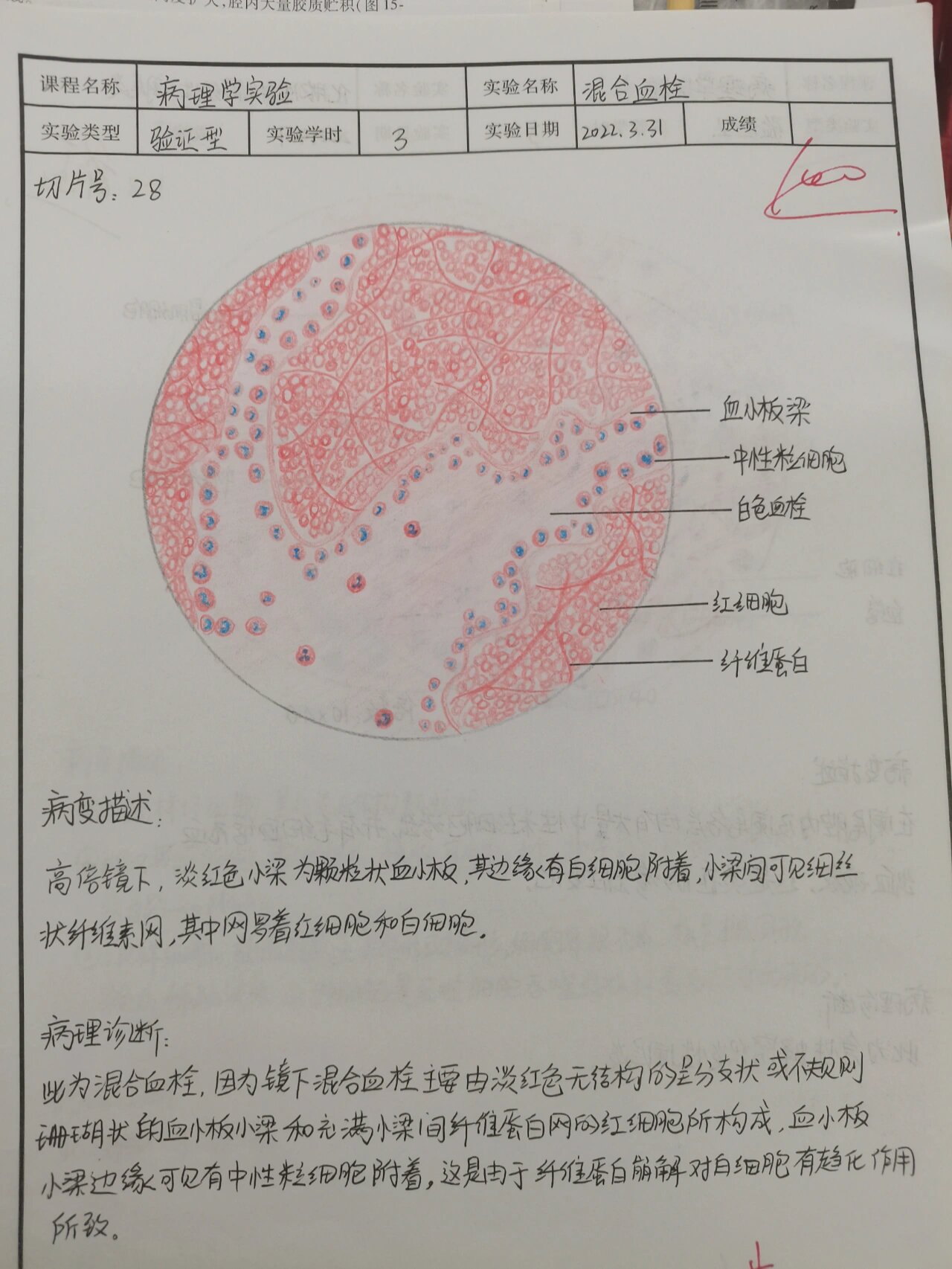 肉芽肿红蓝铅笔手绘图图片