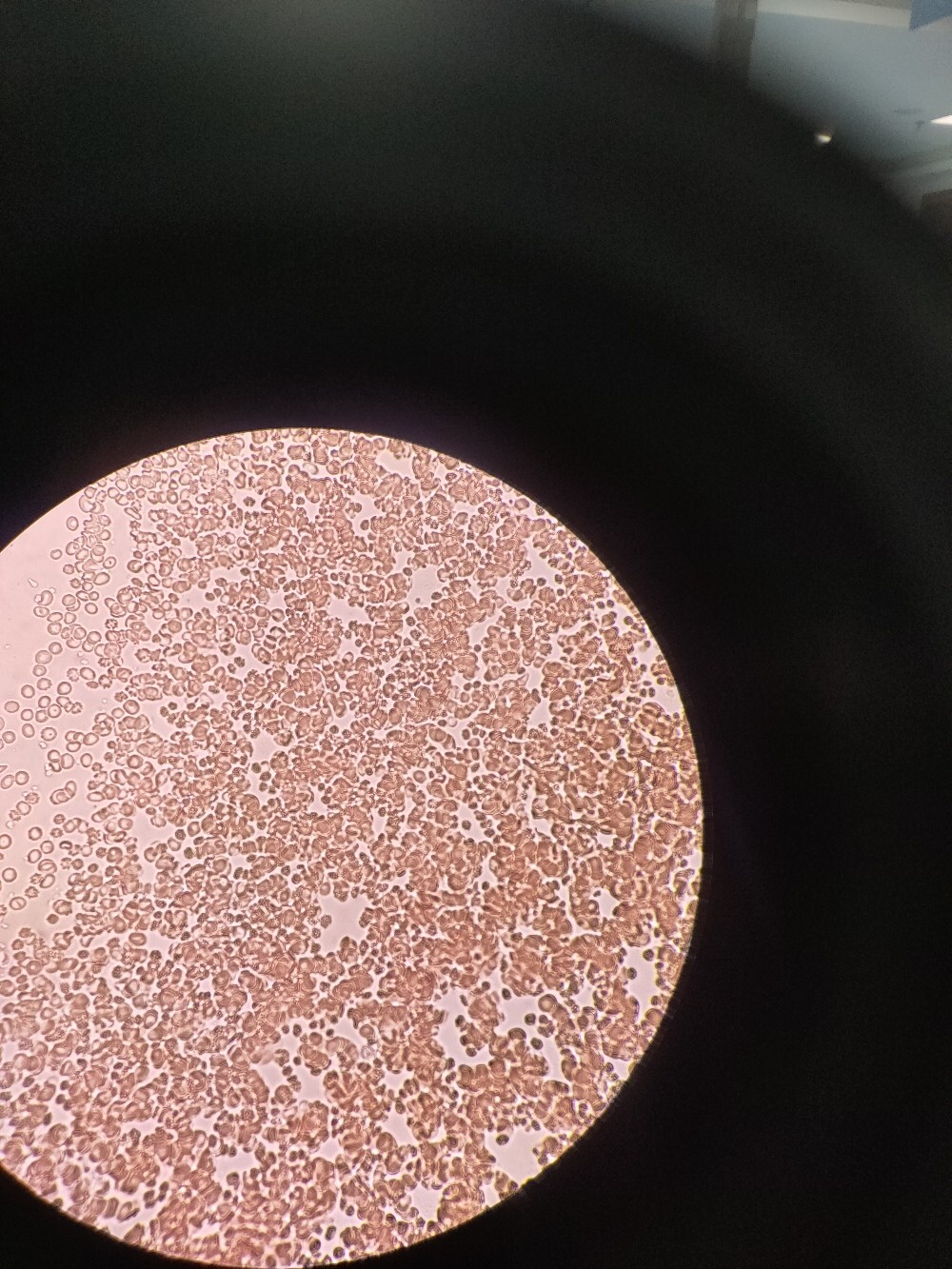粪便中的红细胞图片图片