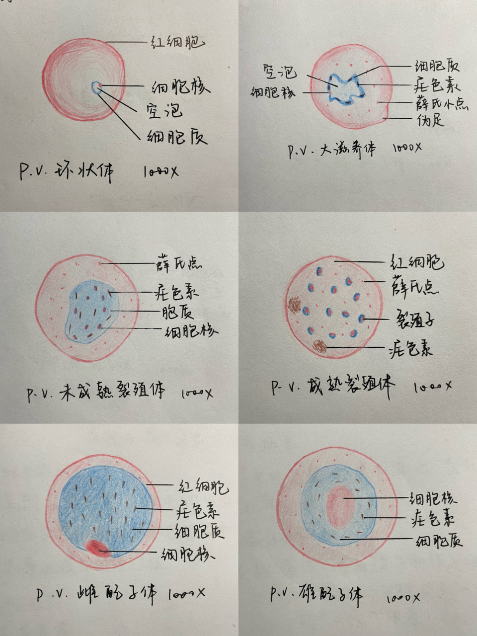 寄生虫手绘图—疟原虫 红蓝铅笔绘图!(为了还原疟色素用了棕色彩铅)