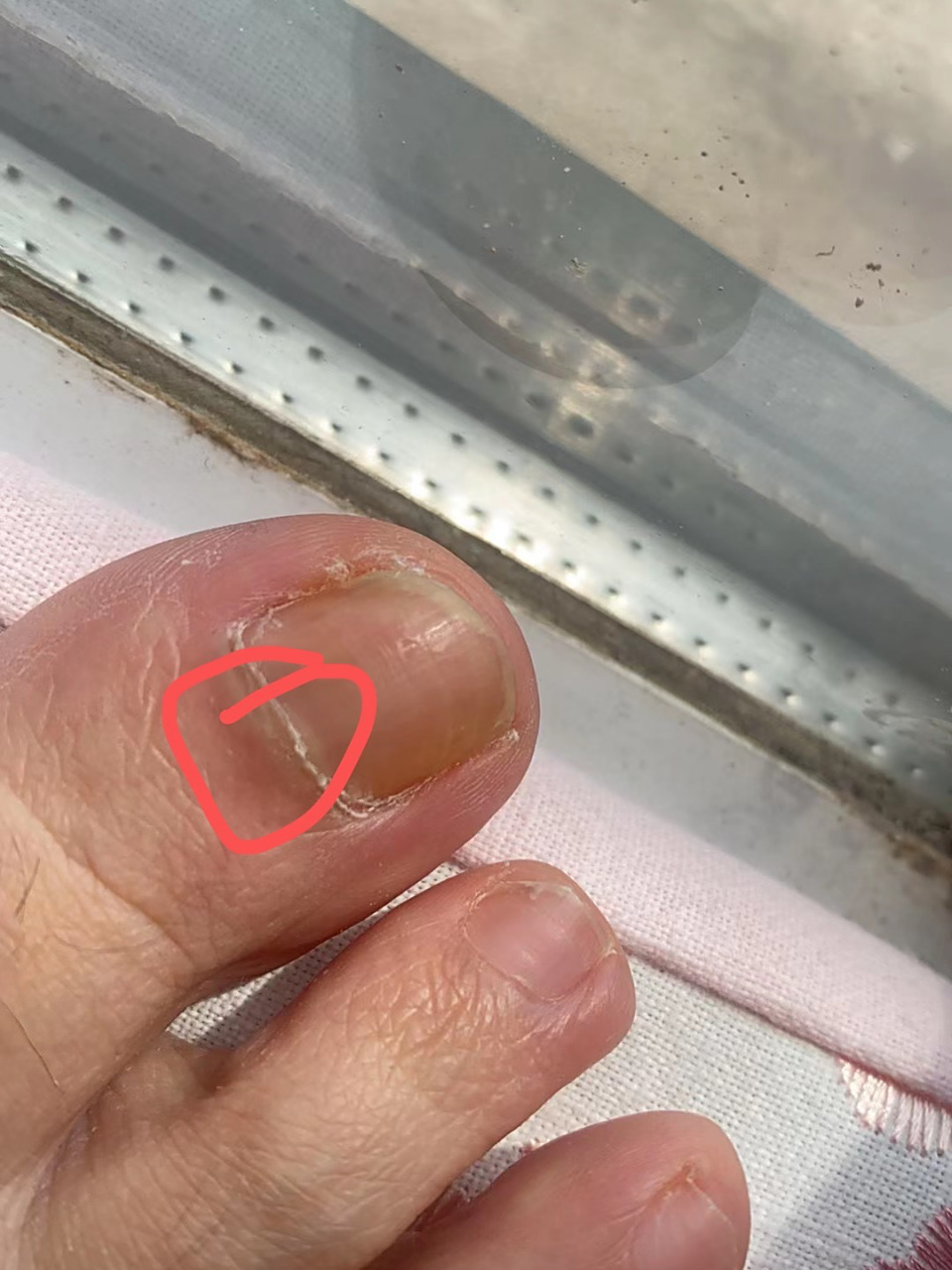 指甲无缘无故的很疼还发黑 指甲无缘无故的疼了好几天,几天看了都发黑