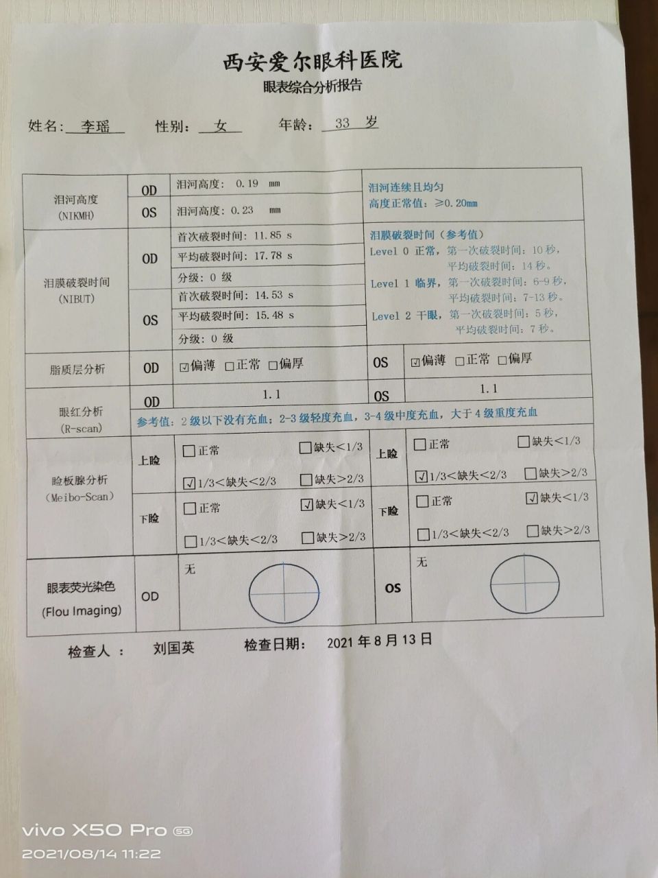 做近视眼手术之前必看之干眼症 这段时间老想着做近视眼手术,真的是不