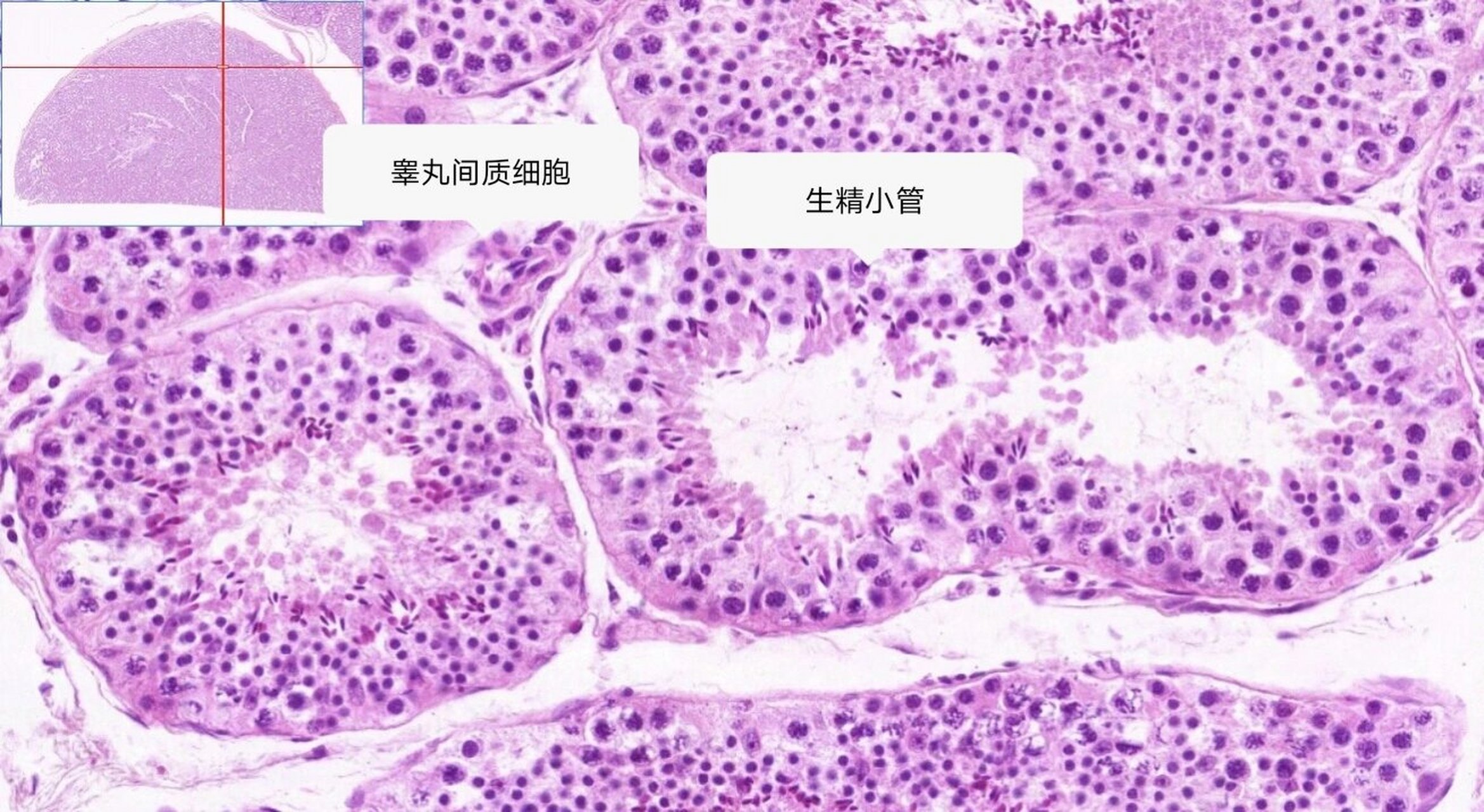 男性生殖系统——睾丸 生精小管相关结构 精原细胞:紧贴基膜,圆形或卵