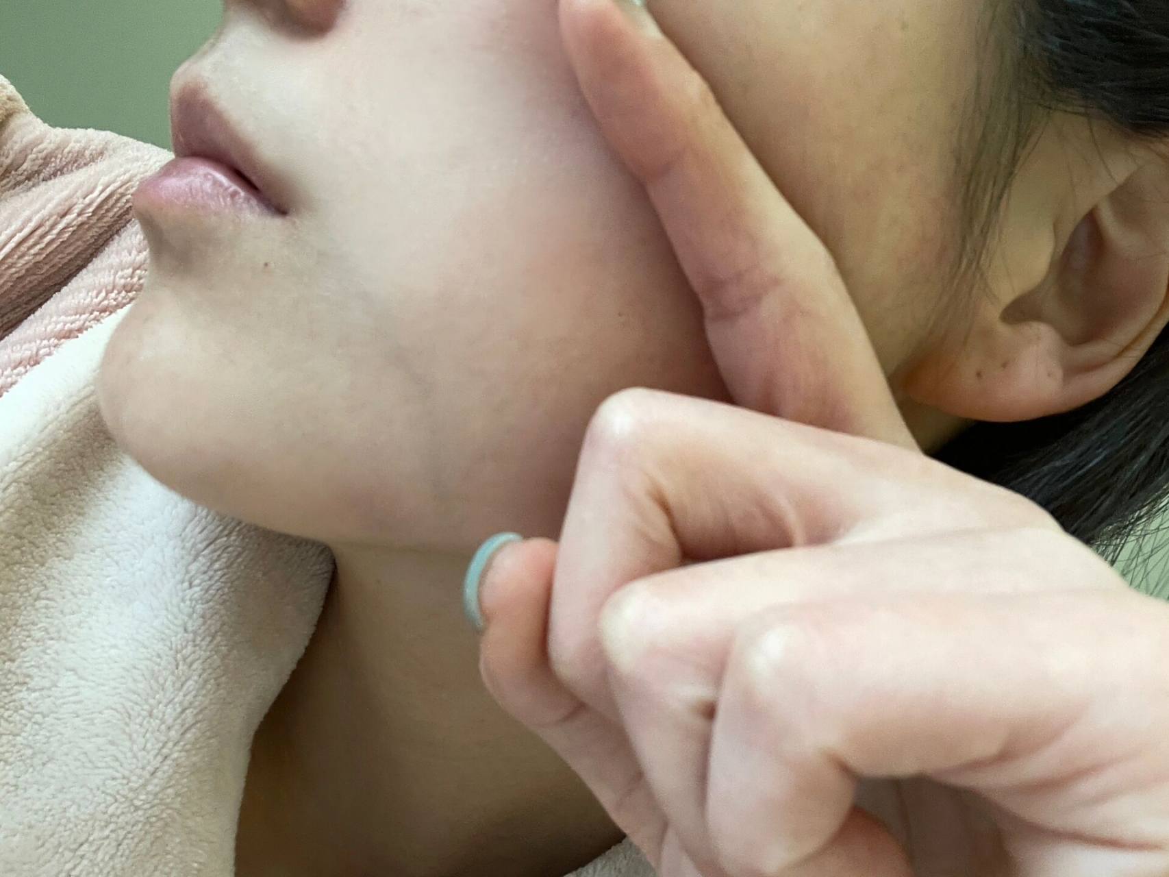 嘴角为啥有条青筋 很不理解我脸上嘴角多一条青筋