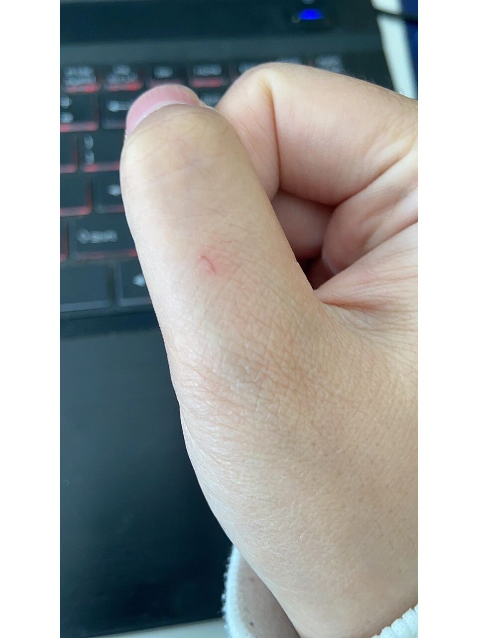 手,划了三处,破皮,第一张图的口子又红又疼的,有点凸起,猫咪还没打