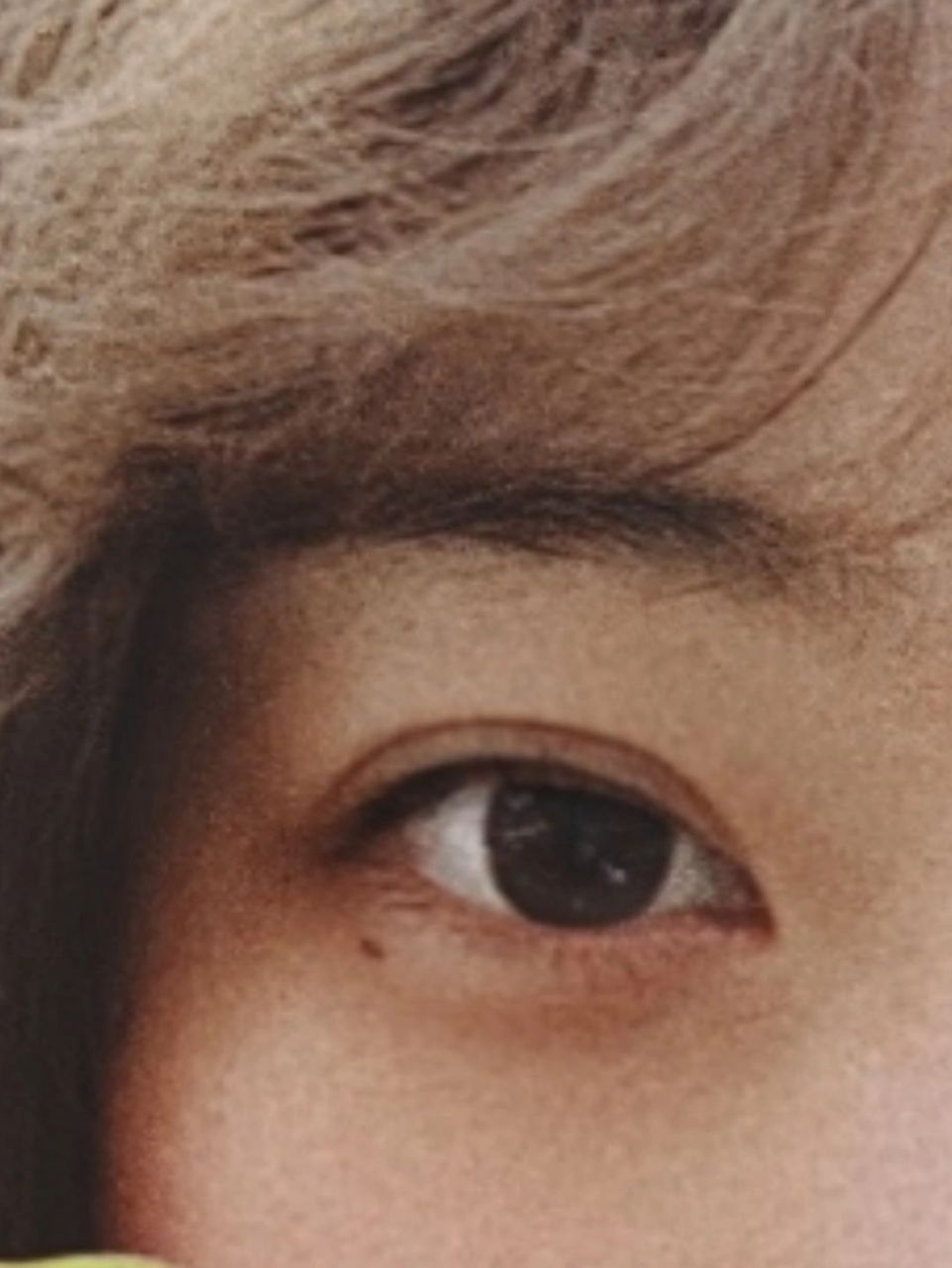 卧蚕上有痣是不是不太好啊 也不知道卧蚕上的痣算不算泪痣,点了两次都