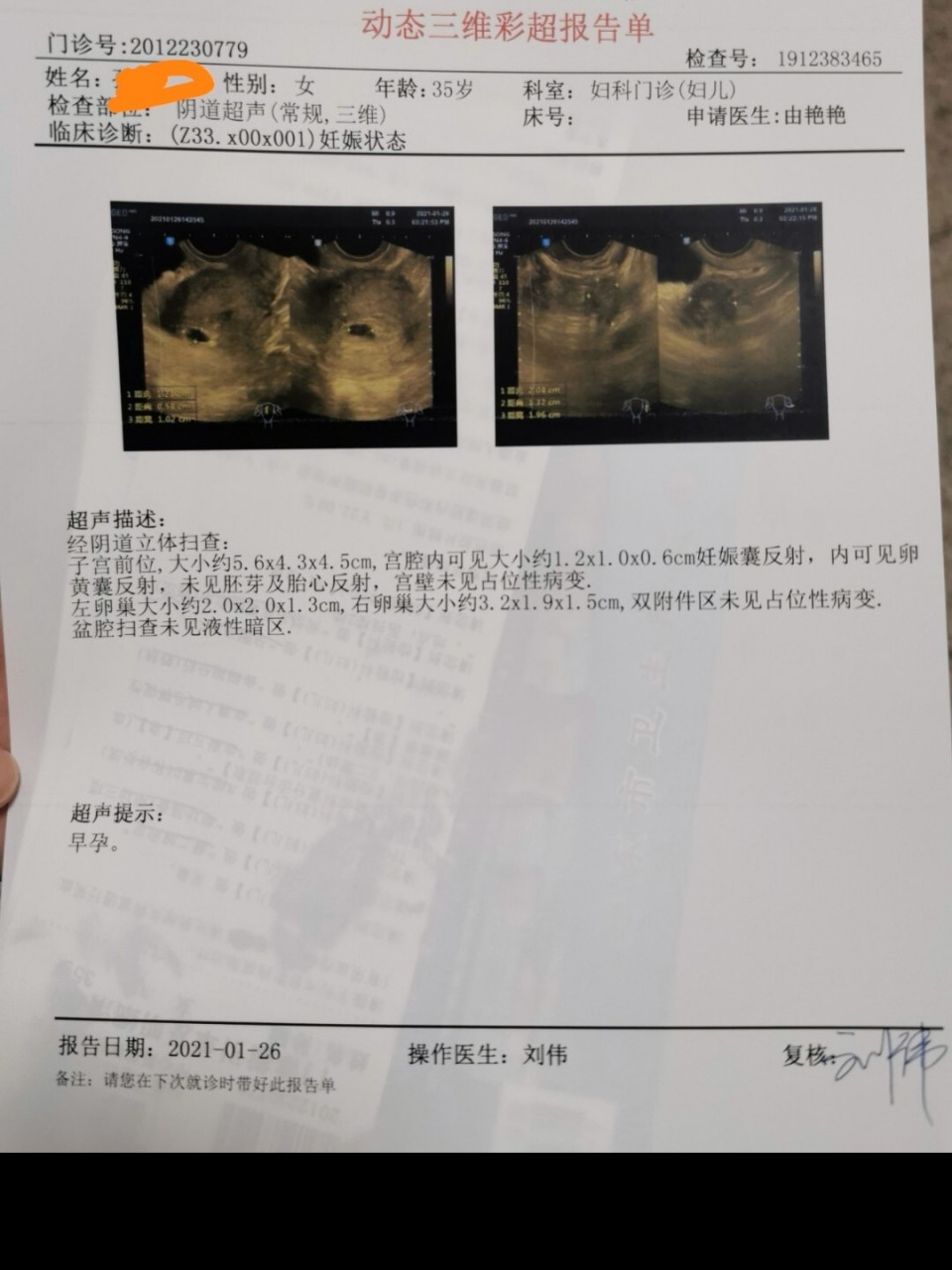 麻烦大家帮忙看看男宝女宝啊,本想去验血查男女,结果过年期间快递停运