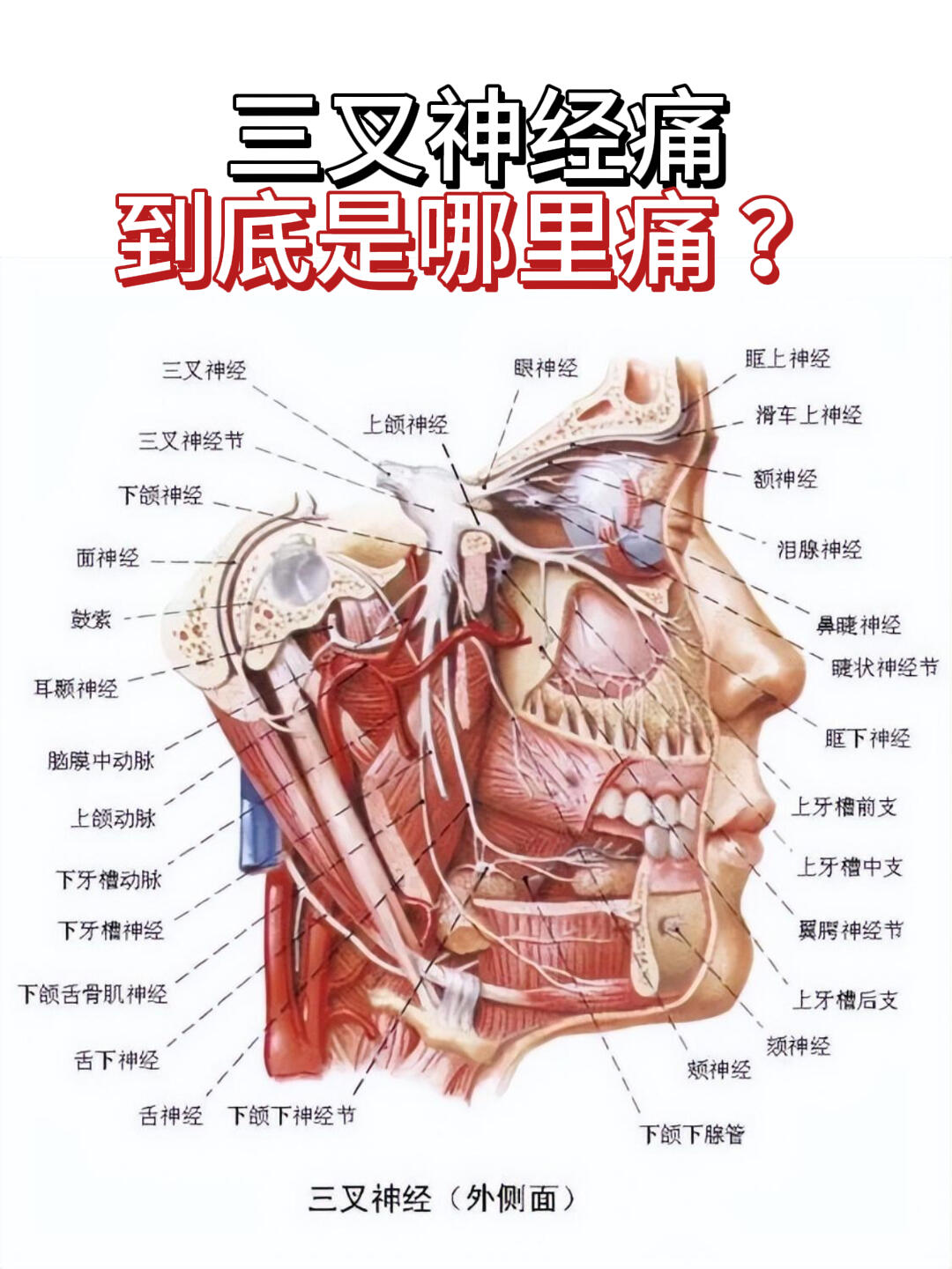 三叉神经痛是指在面部三叉神经分布区出现的疼痛.