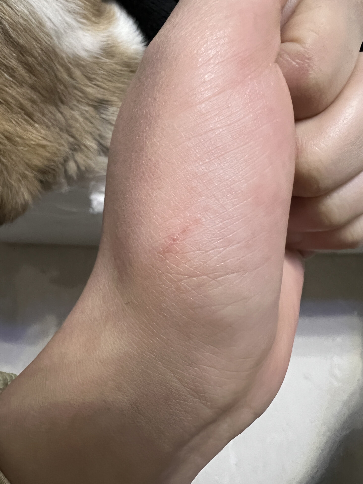 被50天的小奶狗抓伤了要打疫苗吗 被50天的小狗抓伤了一点点 没流血