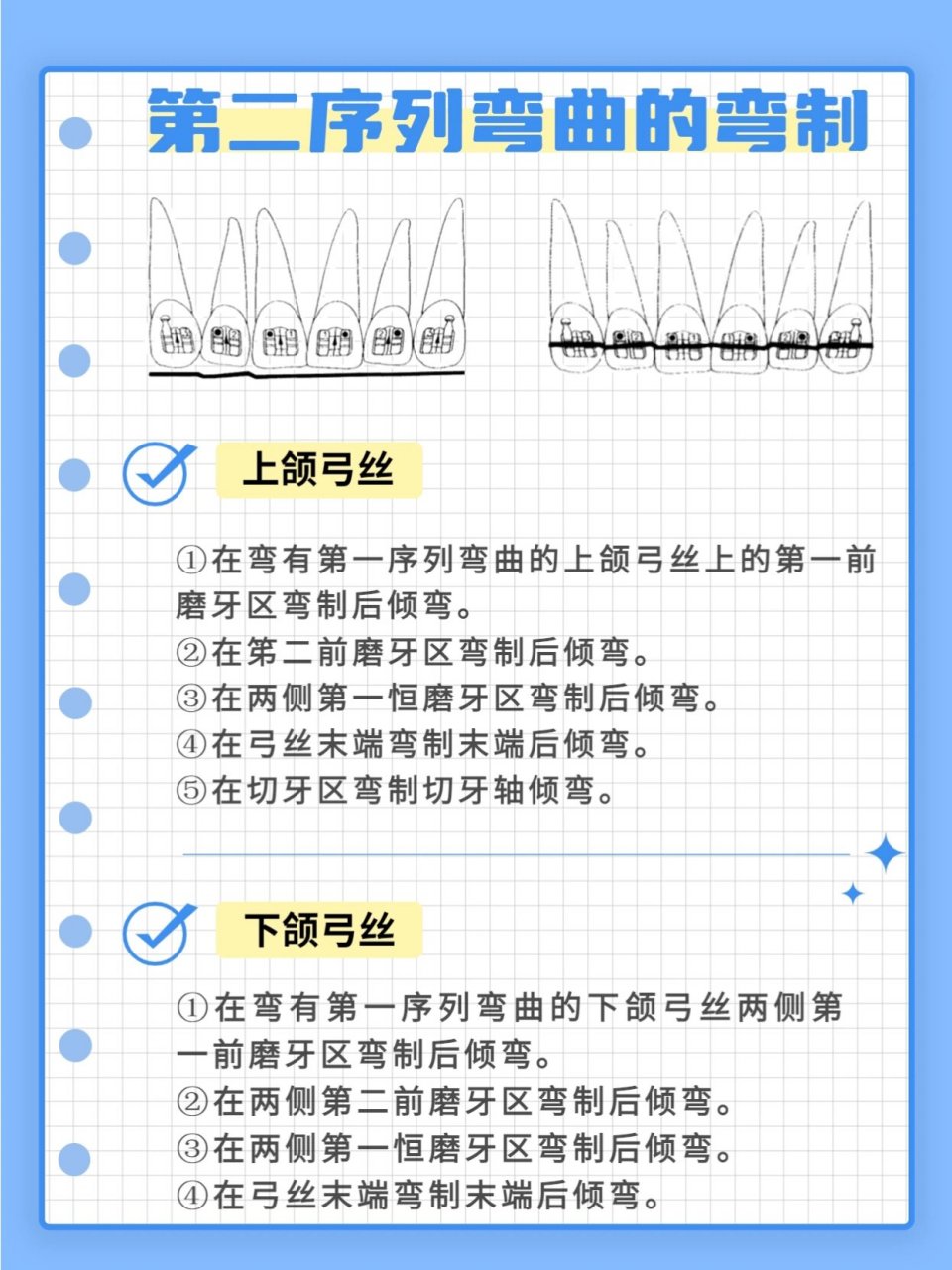 在两侧苐一恒磨牙区弯制后倾弯.