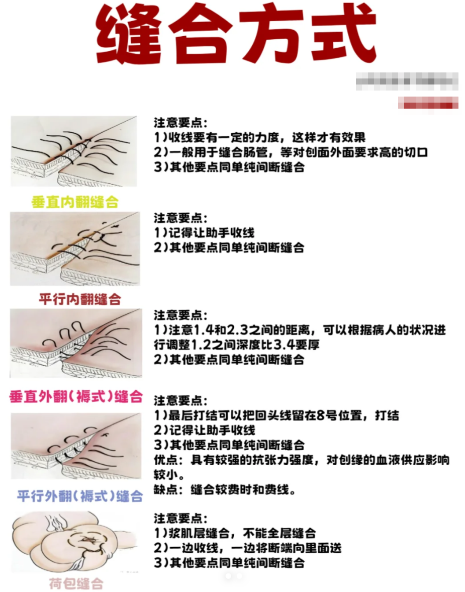 手术缝合的方法有什么?