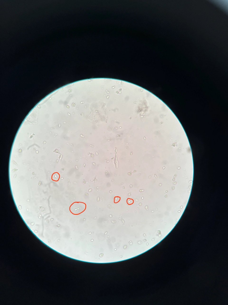 医学检验的友友 白带霉菌镜下形态怎么看 把你们的霉菌发在评论区我