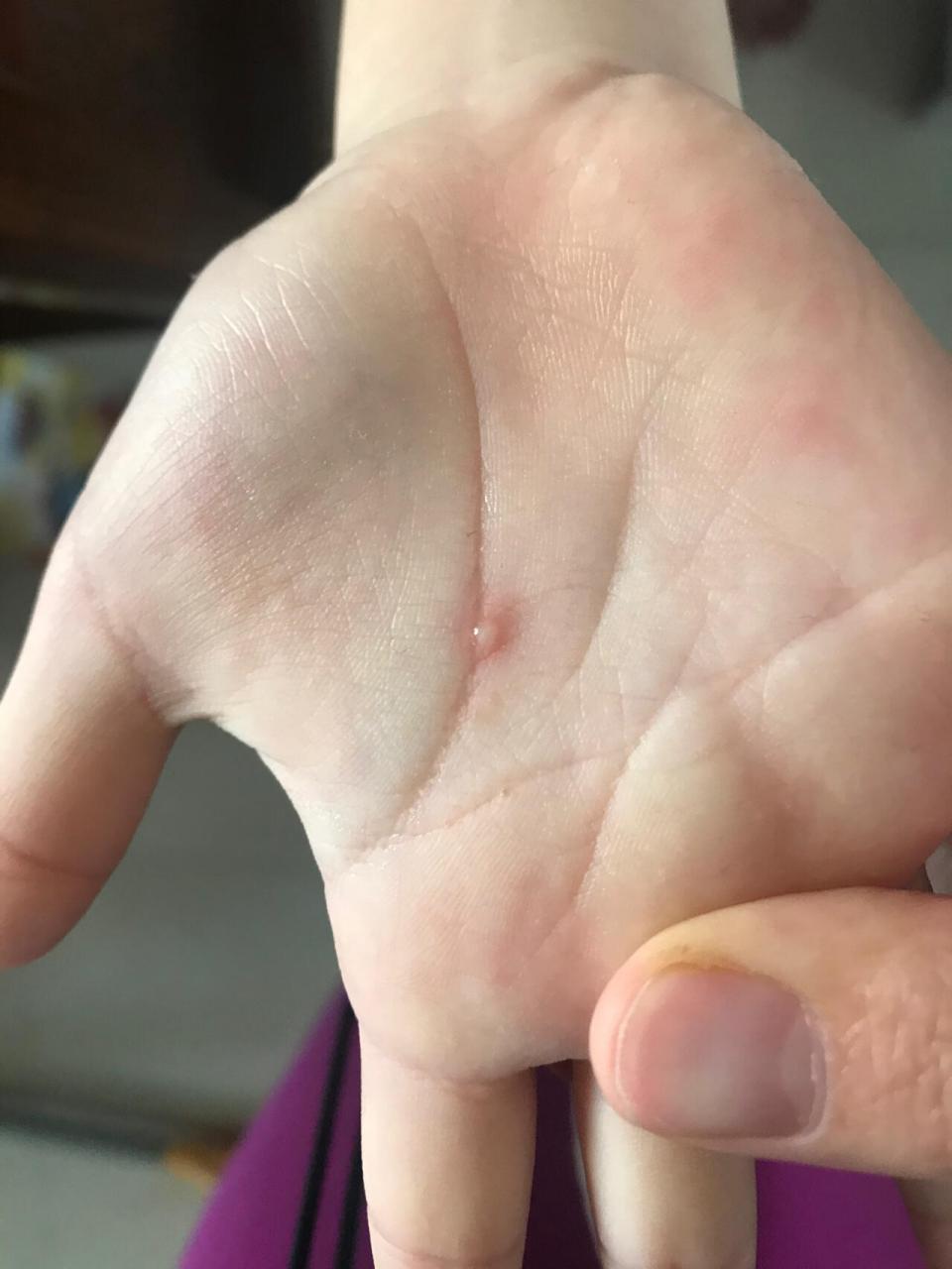 这个应该会对家里有宝贝的有帮助 昨天早上大师兄跟