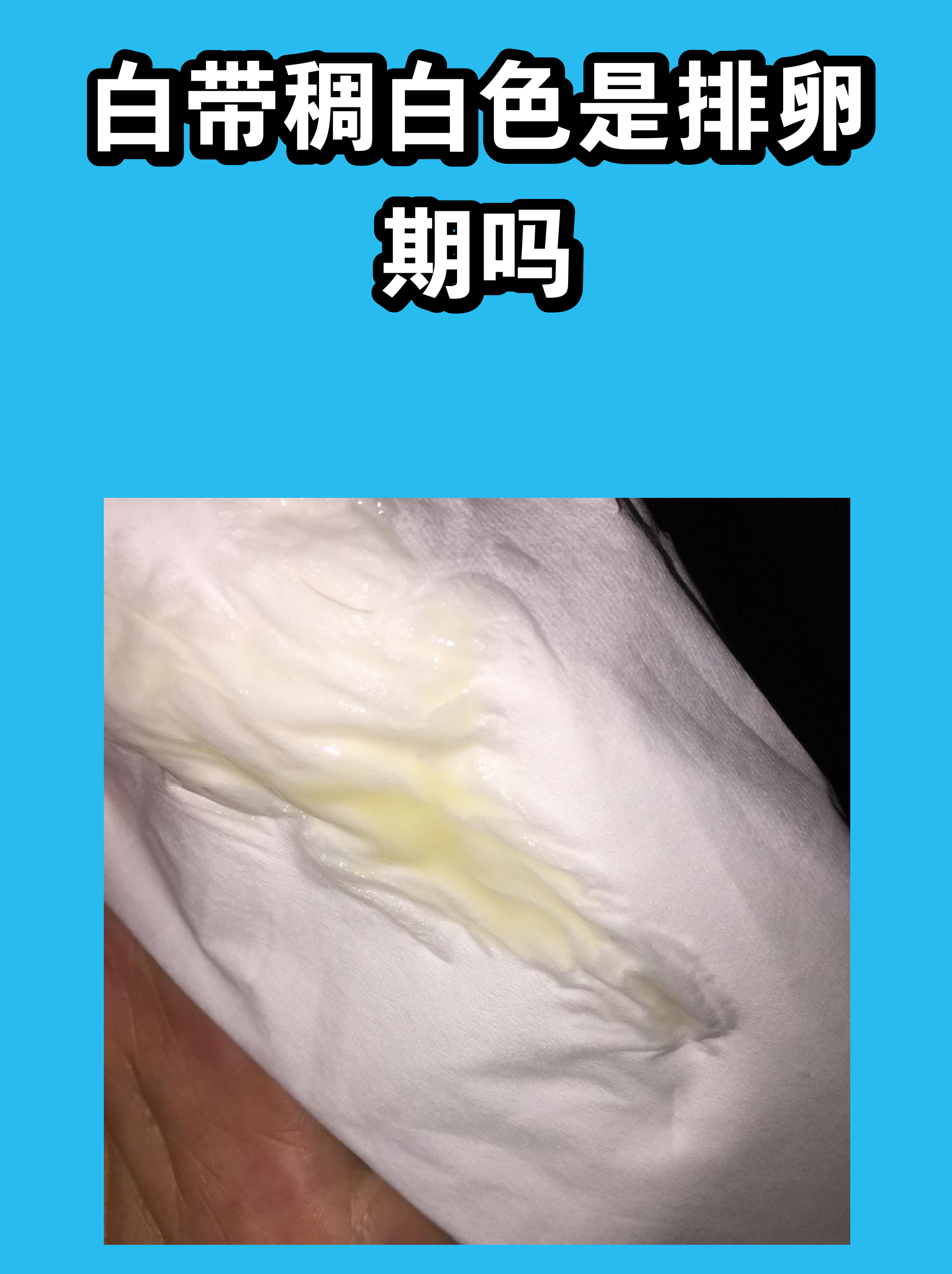 白带稠白色是排卵期吗