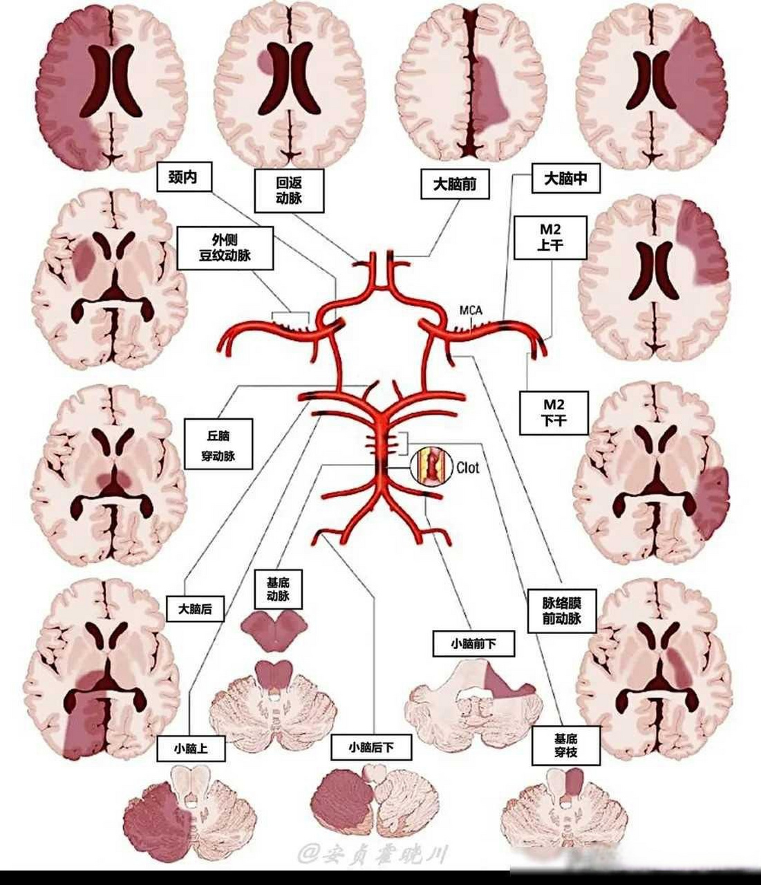 大脑动脉环简图图片