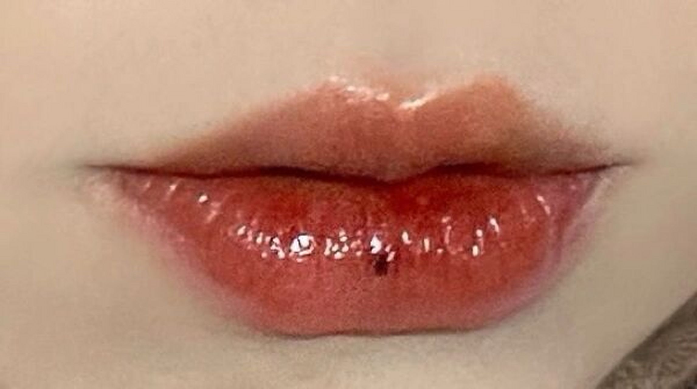 嘴唇这个位置上长痣要不要点掉呀?