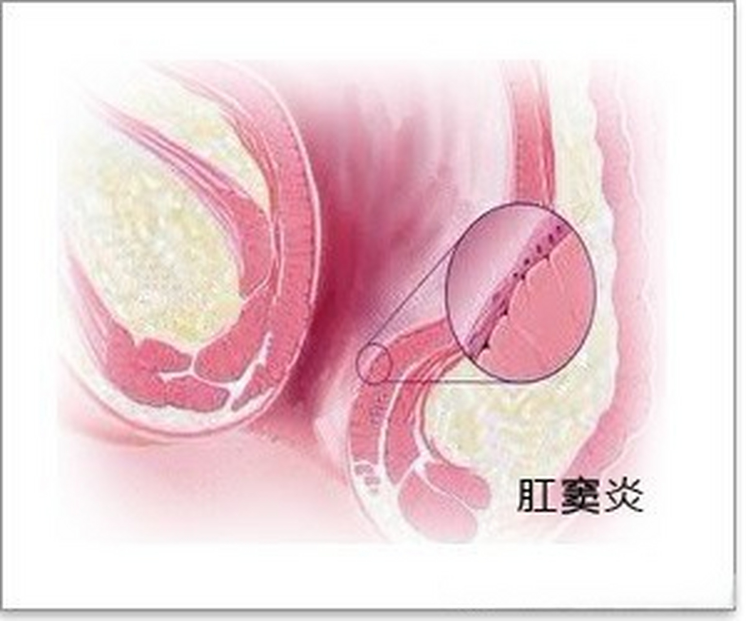 户外白钢门图图片