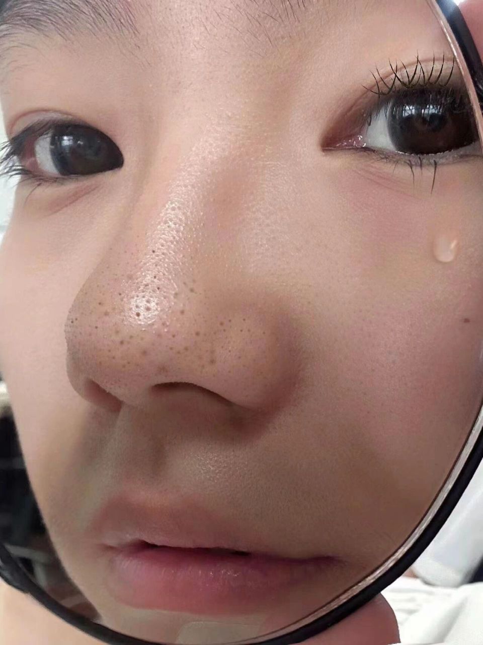 黑头姐妹都给我去揉! 夏天了鼻子上的黑点点肉眼可见的在扩散.