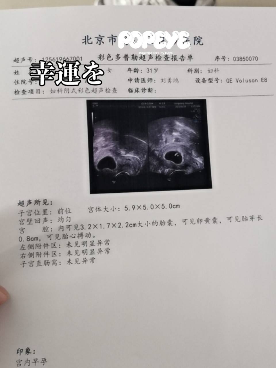 怀孕53天终于等来胎心胎芽 去年经历过一次胎停 染色体检查没有任何