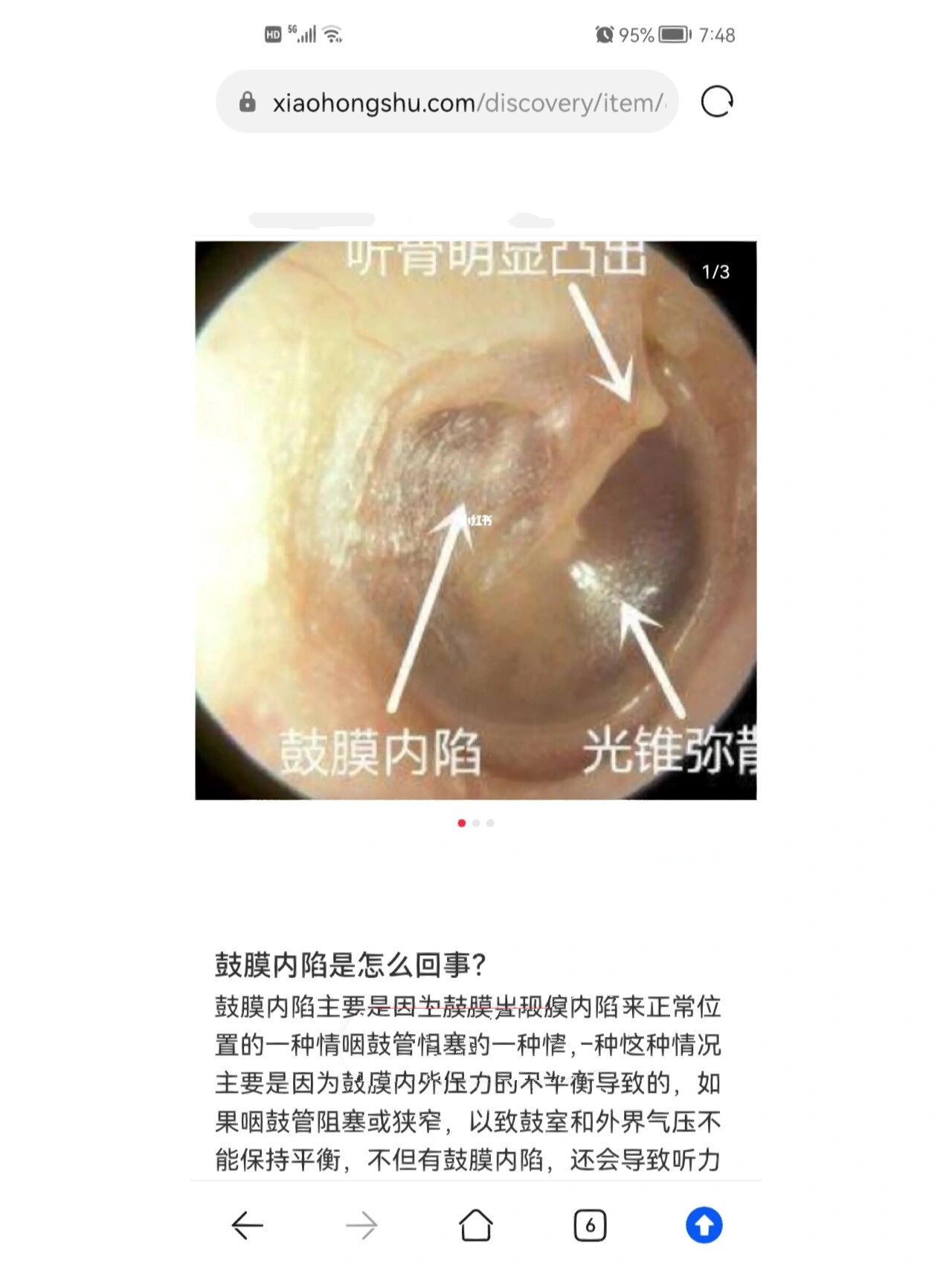 耳朵光锥图片图片