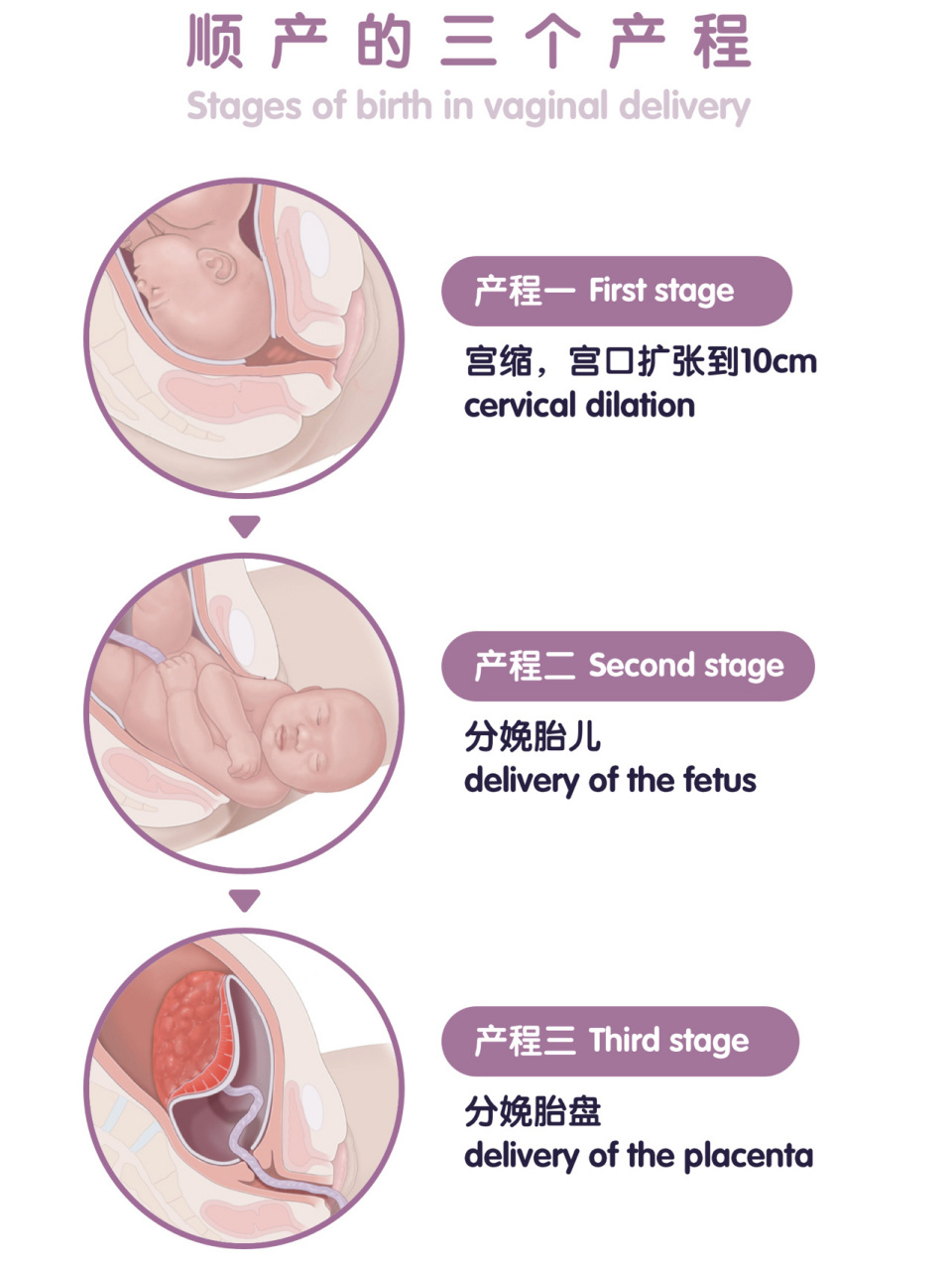 顺产照片扩宫图片