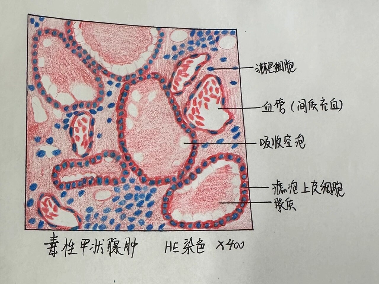 甲状腺红蓝铅笔绘图图片