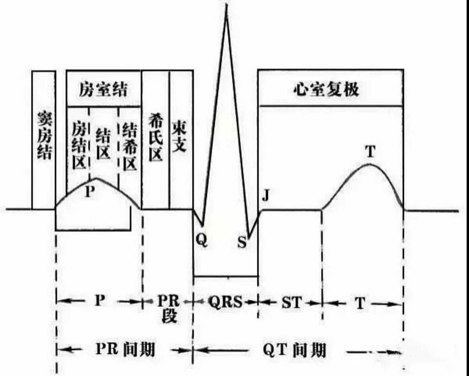 p波:代表心房除极过程,所以 p波出现异常往往代表心房的问题.