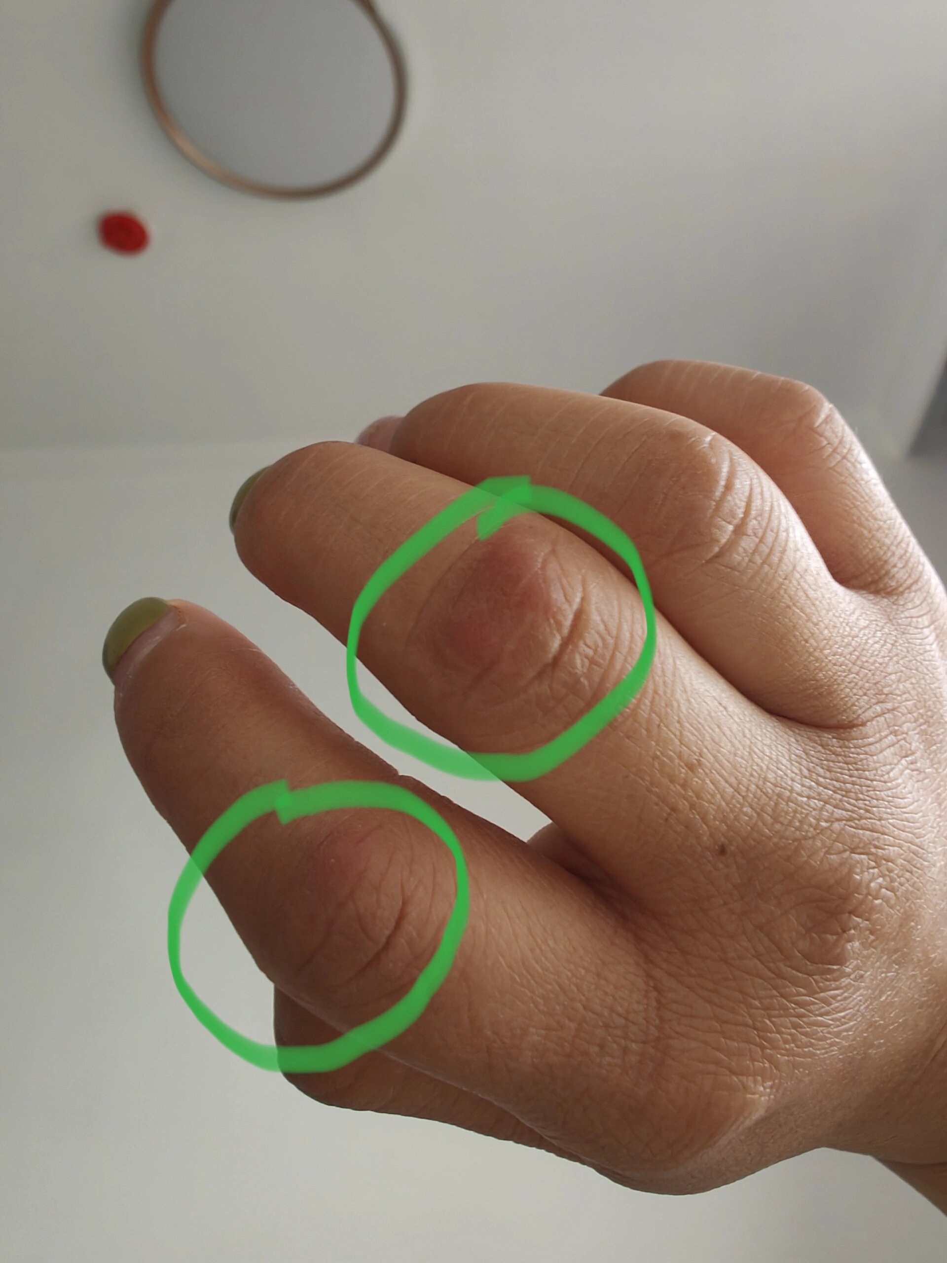 手指关节红疙瘩,有点疼有点痒 有见多识广的姐妹知道是什么吗?