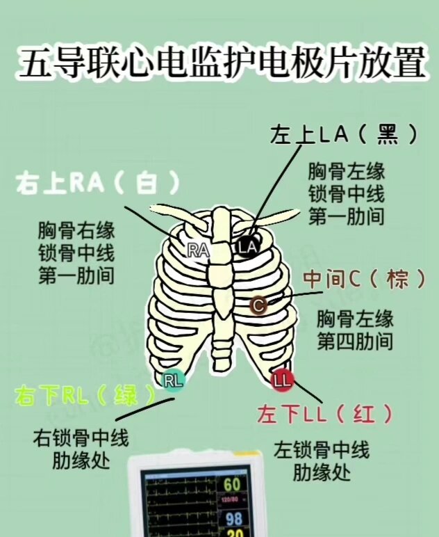 心电监护仪位置图图片